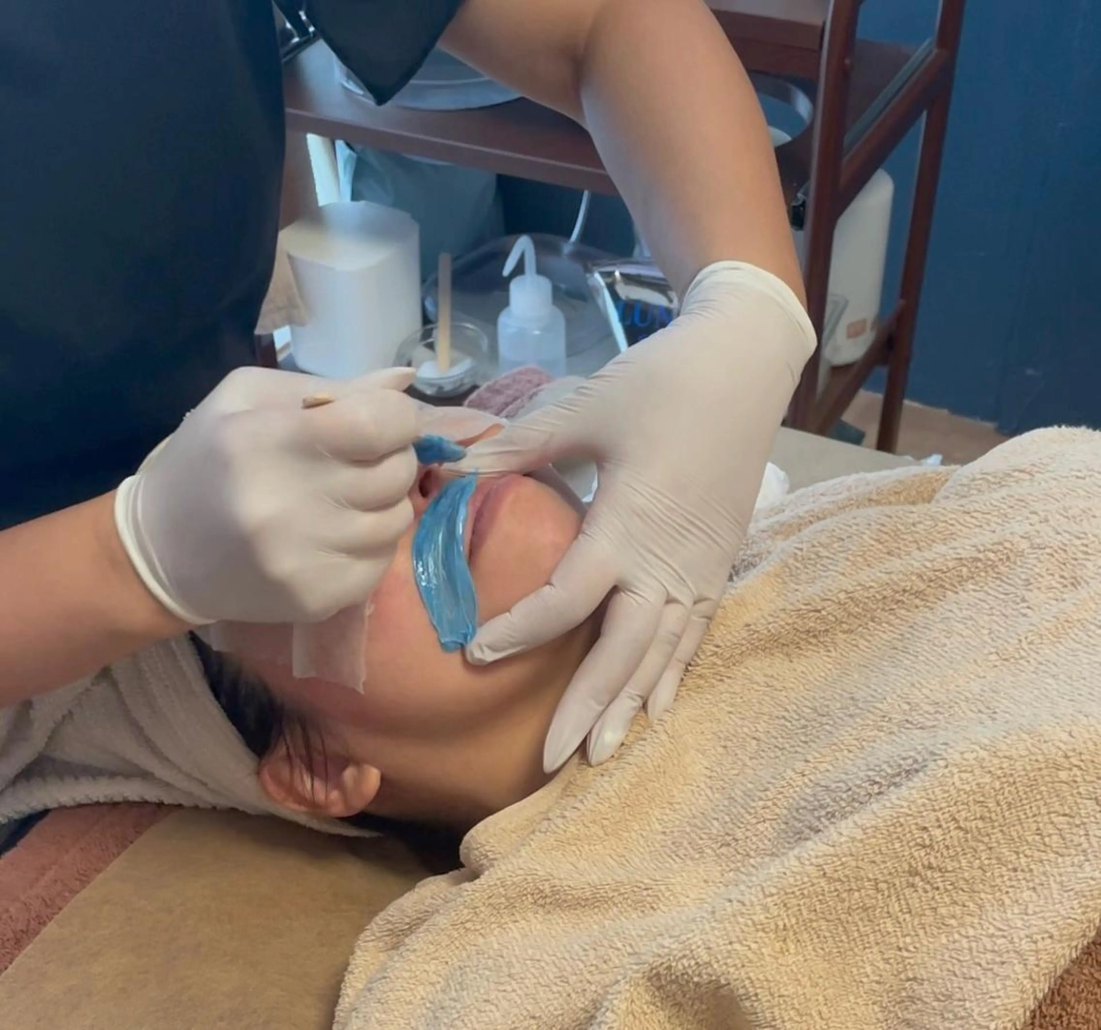 💆‍♀️産毛もつるん♪お顔のWax脱毛の写真