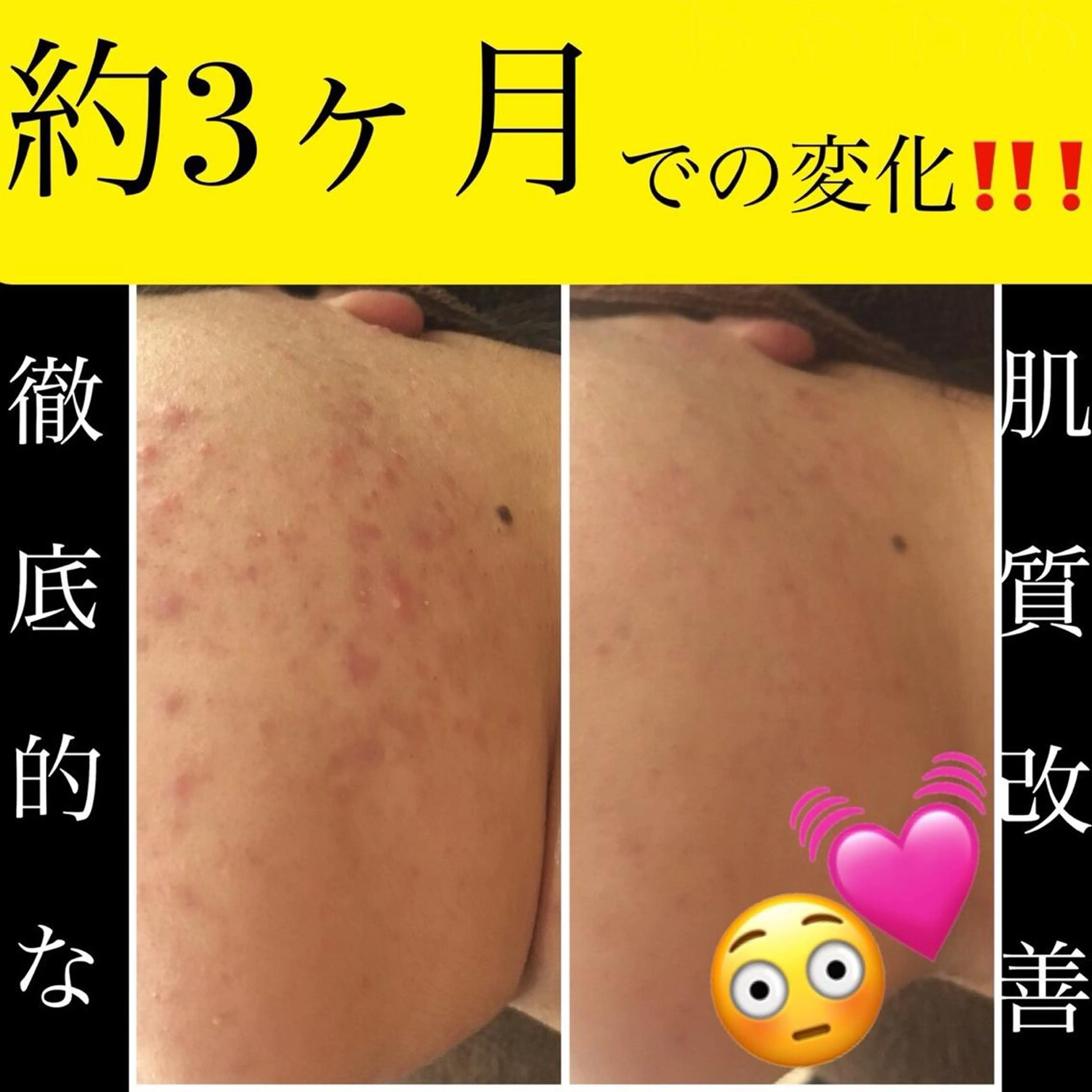 ミディアム カラー パーマ ヘアアレンジ メンズ キッズ ネイル マツエク・マツパ アクール　齋藤 ♡肌トラブル卒業のエステ・リラクイメージ