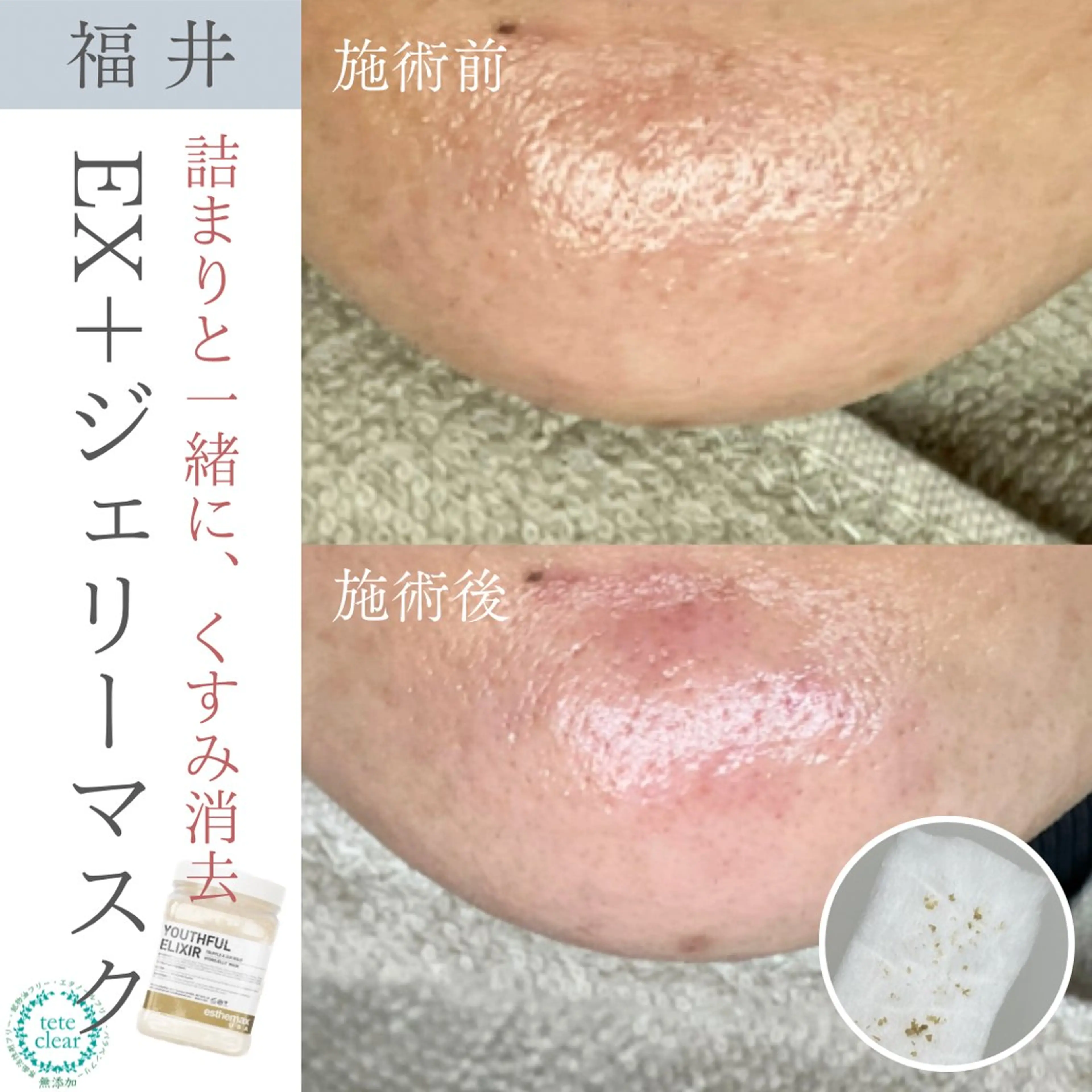 毛穴ケア専門サロン Yourmeユアミーのエステ・リラクイメージ