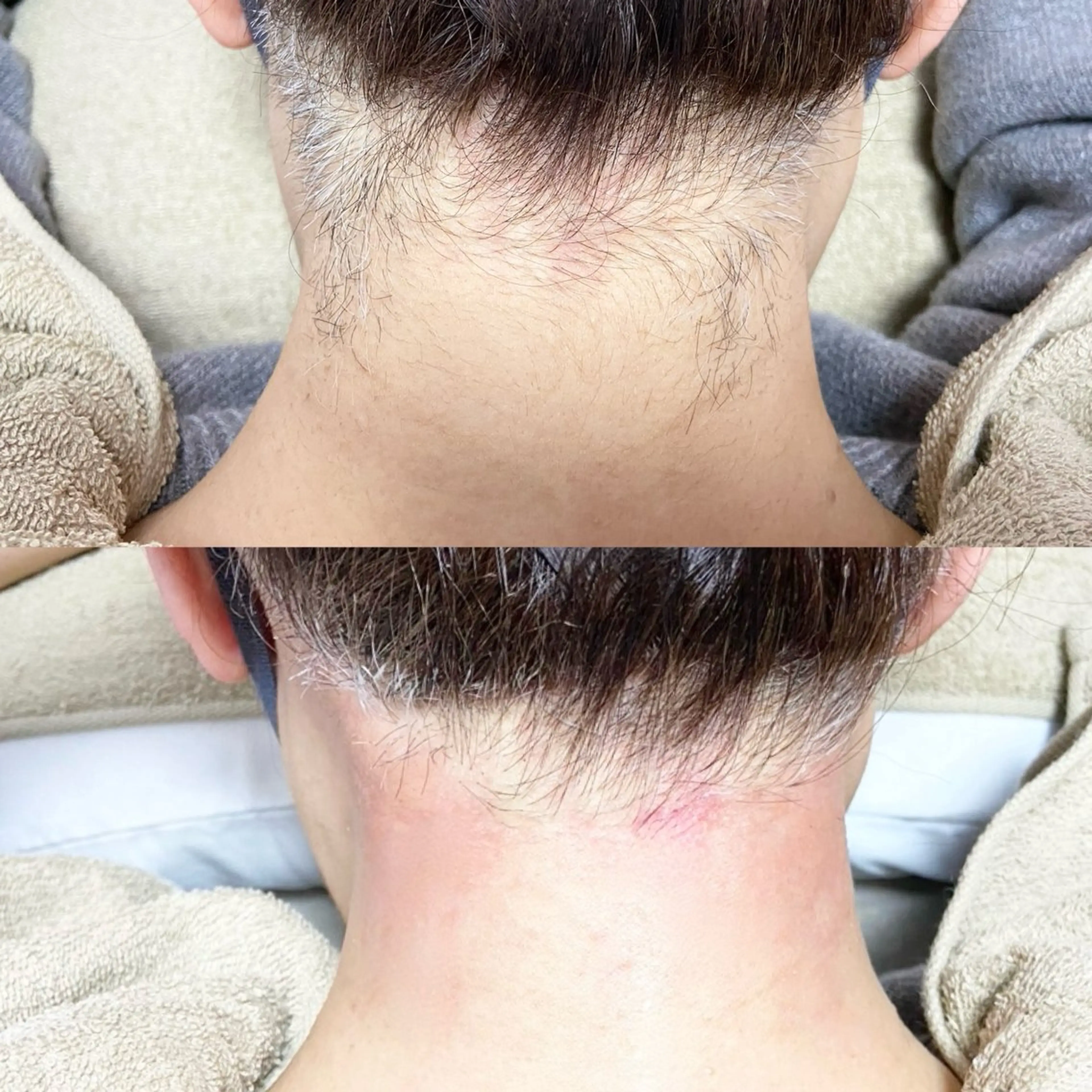 脱毛 &me ayakaのエステ・リラクイメージ