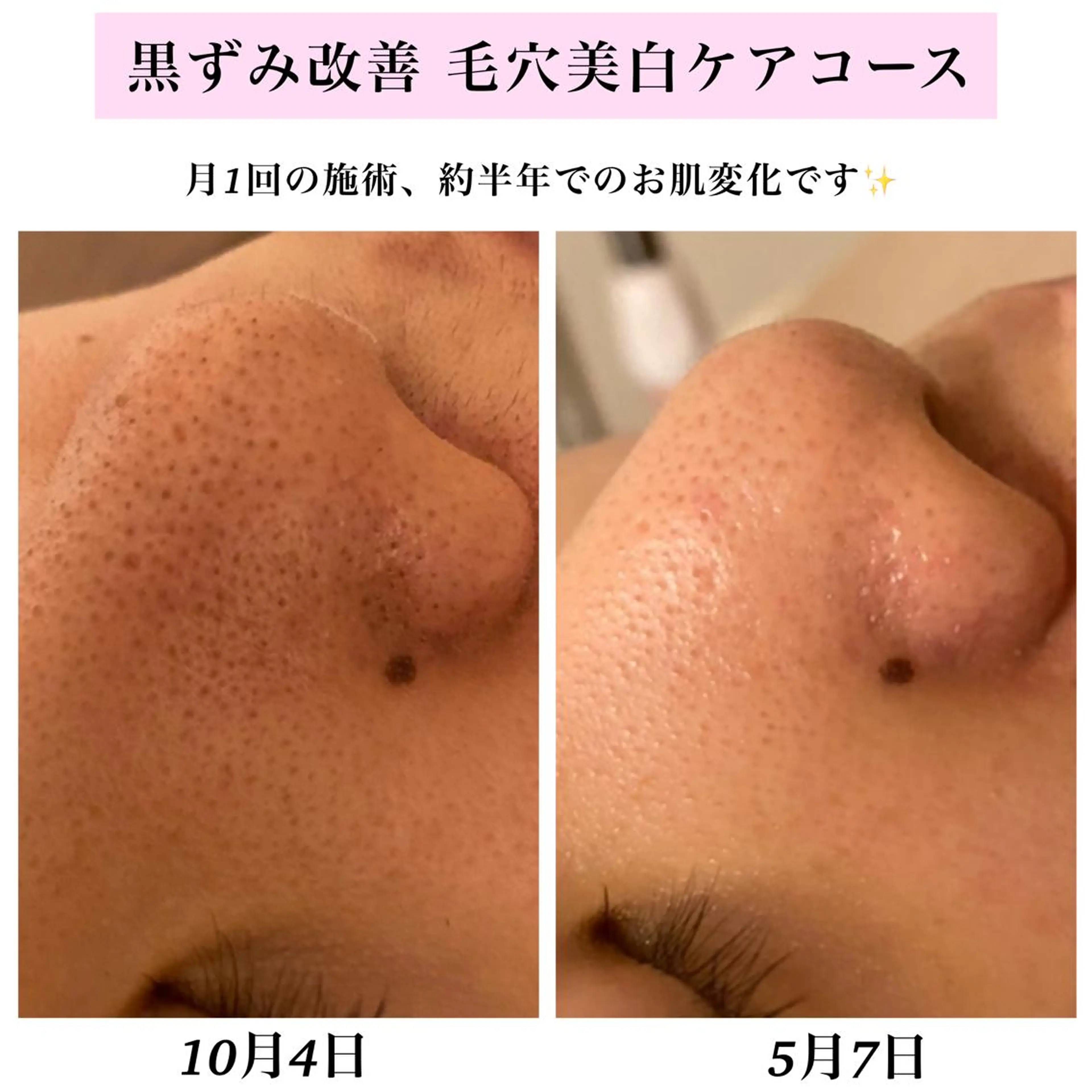 エステ リラク Bellesthe （ベルエステ）のエステ・リラクイメージ