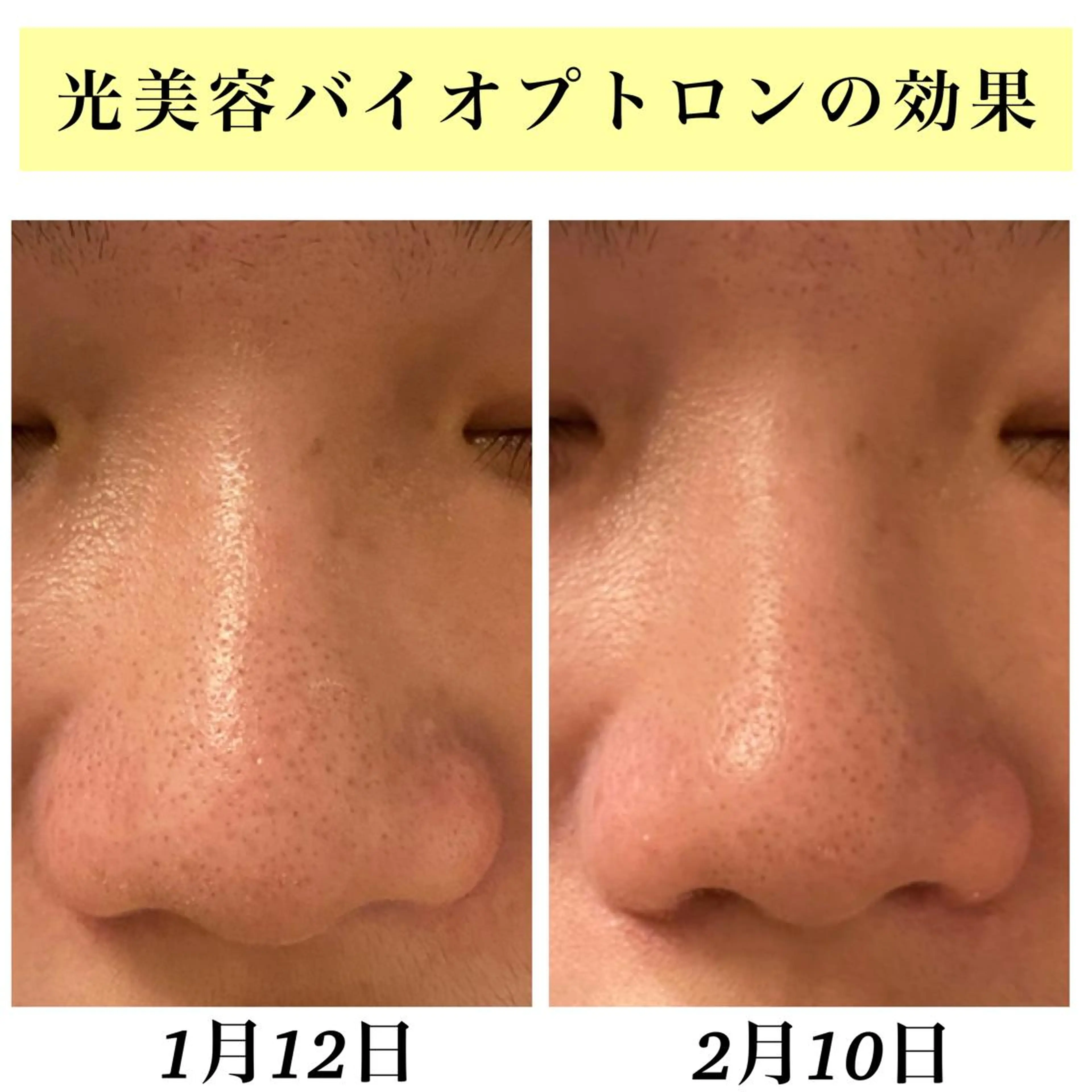 エステ リラク Bellesthe （ベルエステ）のエステ・リラクイメージ