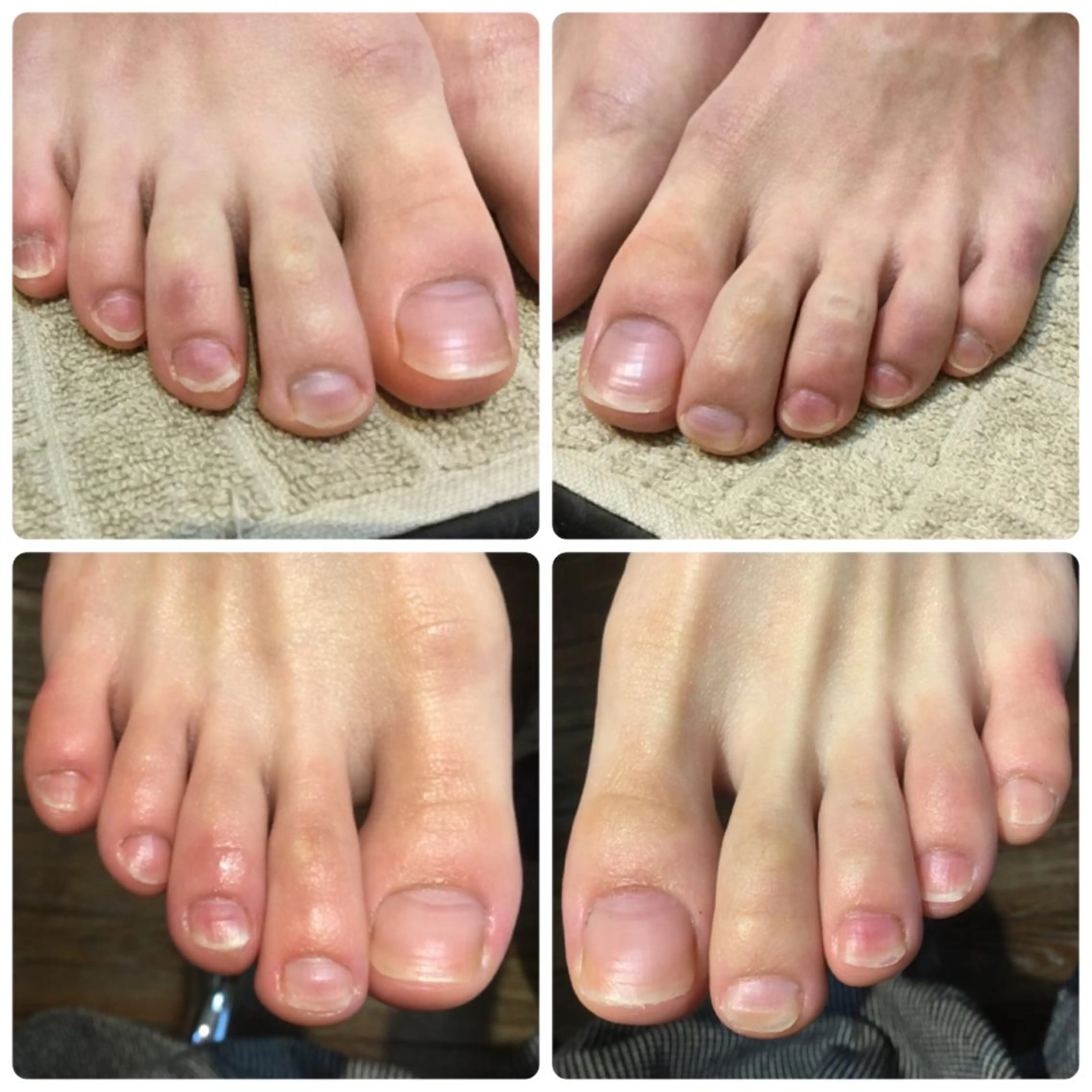 フットケア(爪と甘皮のお手入れ)の写真