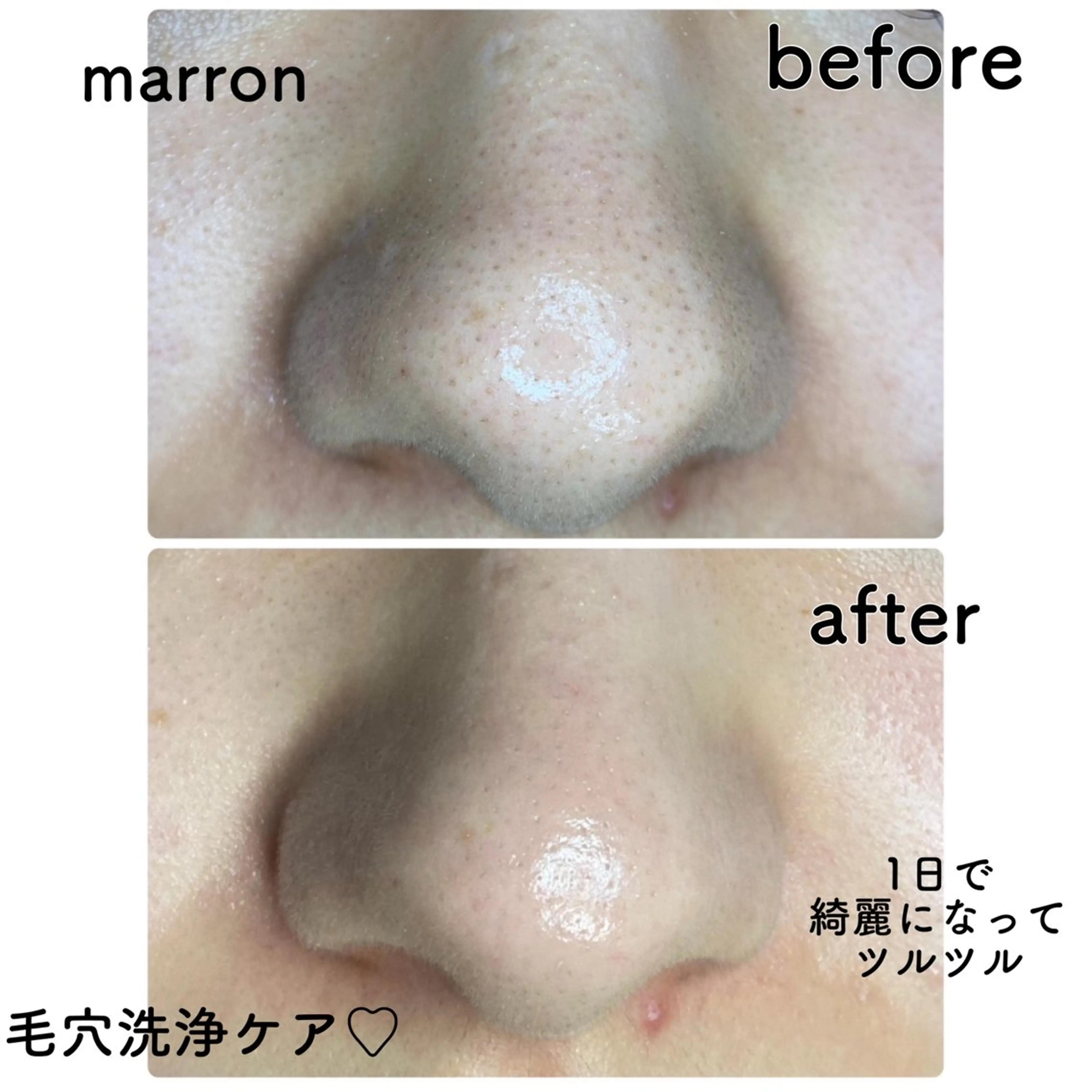 エステ marron所属・痩身ハイパーナイフ ララピールリアボーテのエステ・リラクイメージ