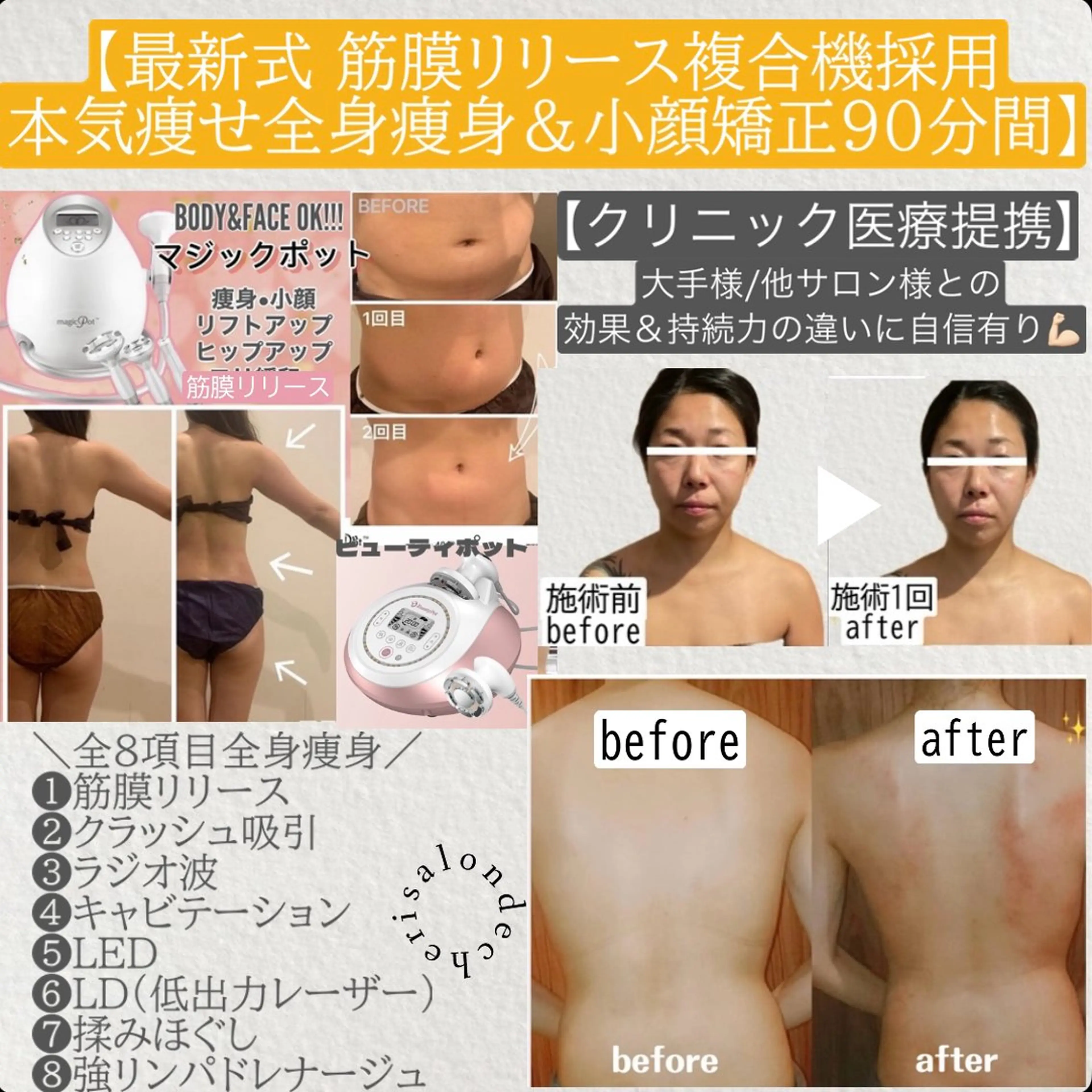 【全身痩身＆小顔矯正90分間】ダイエット結果出し🏆インディバ/冷却超え最新痩身機で本気痩せ👙医療提携ダイエット🩺の写真