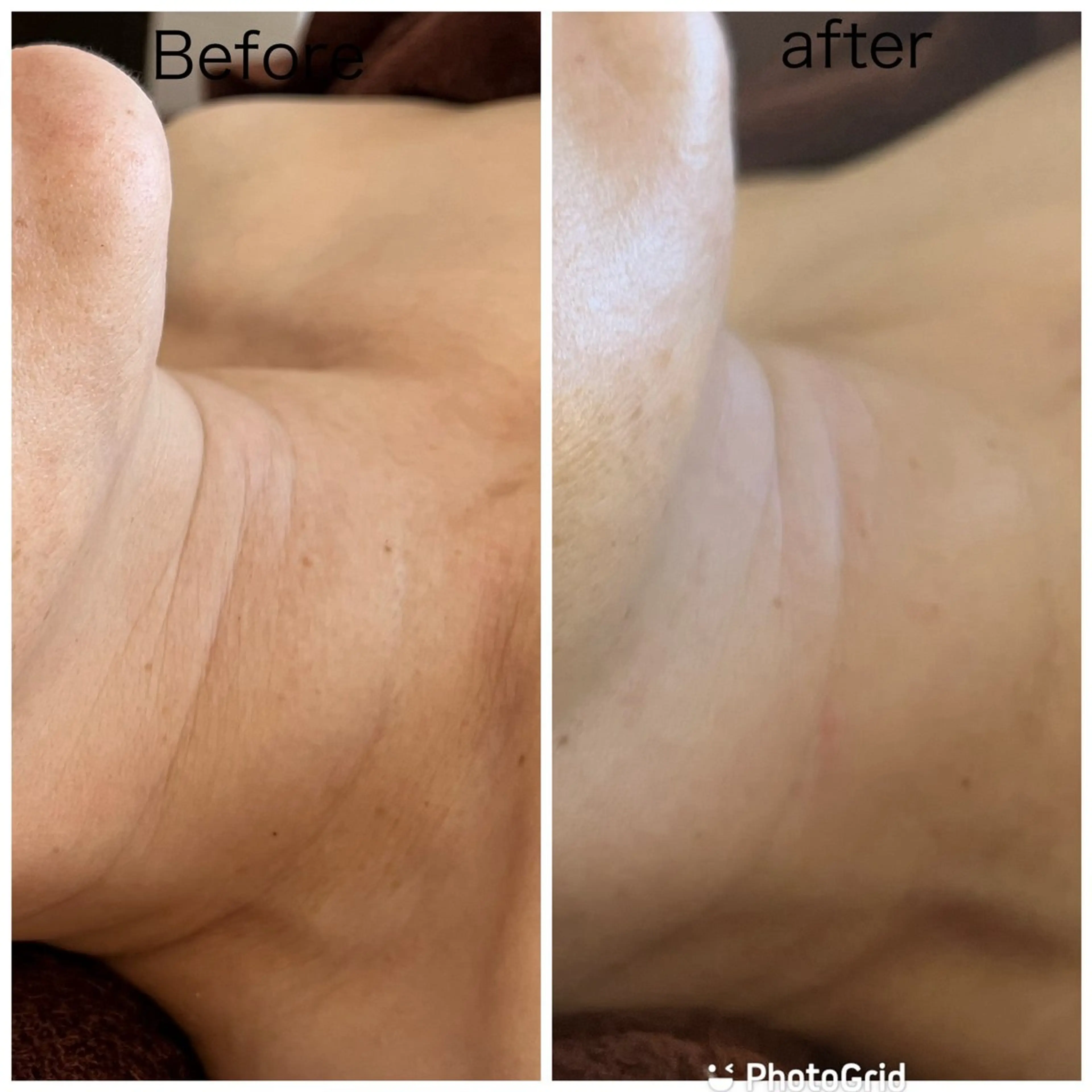 エステ エイジングケア専門 Ponolaのエステ・リラクイメージ