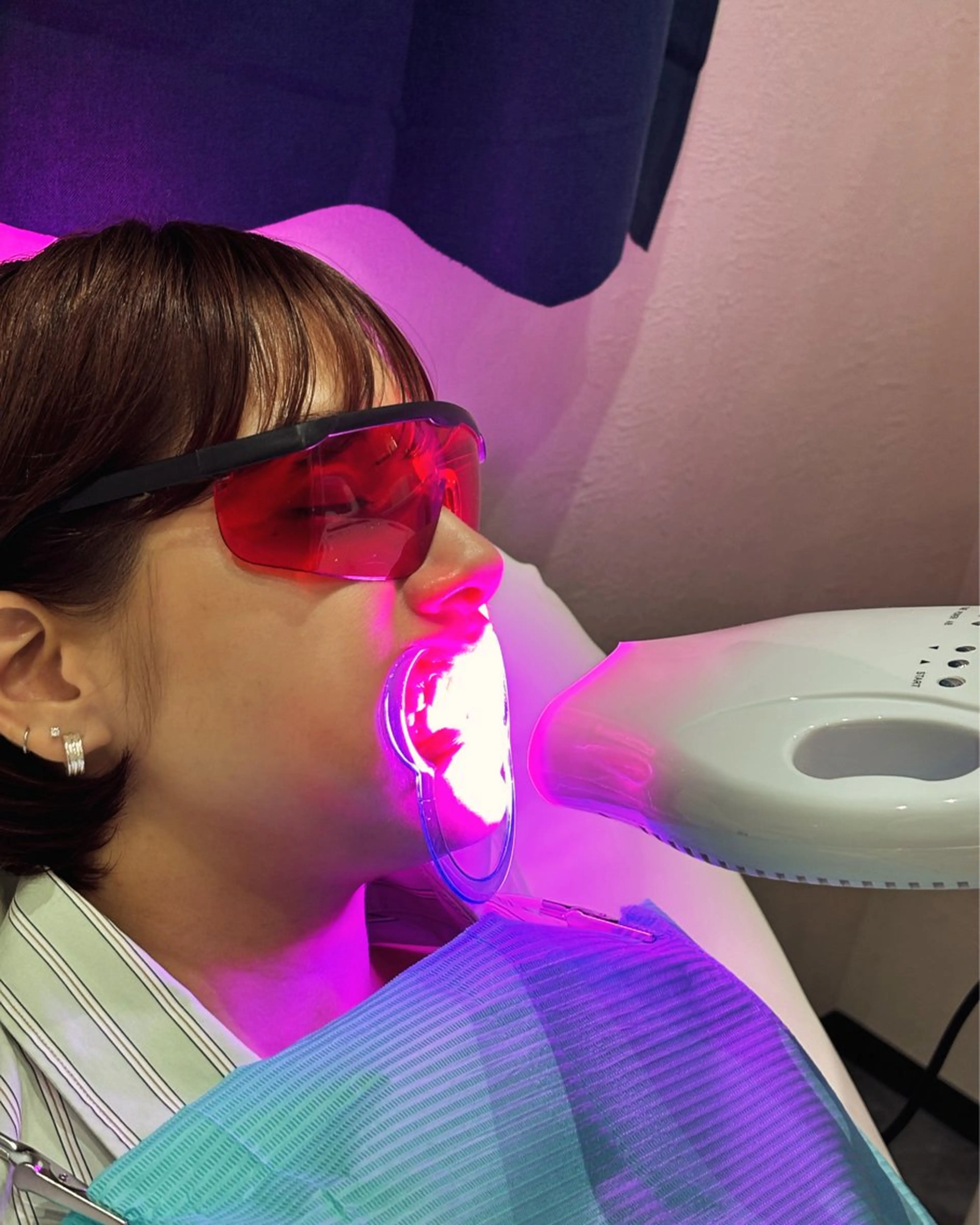 《1ヶ月以内再来》【セルフホワイトニング】8分×3セットの写真