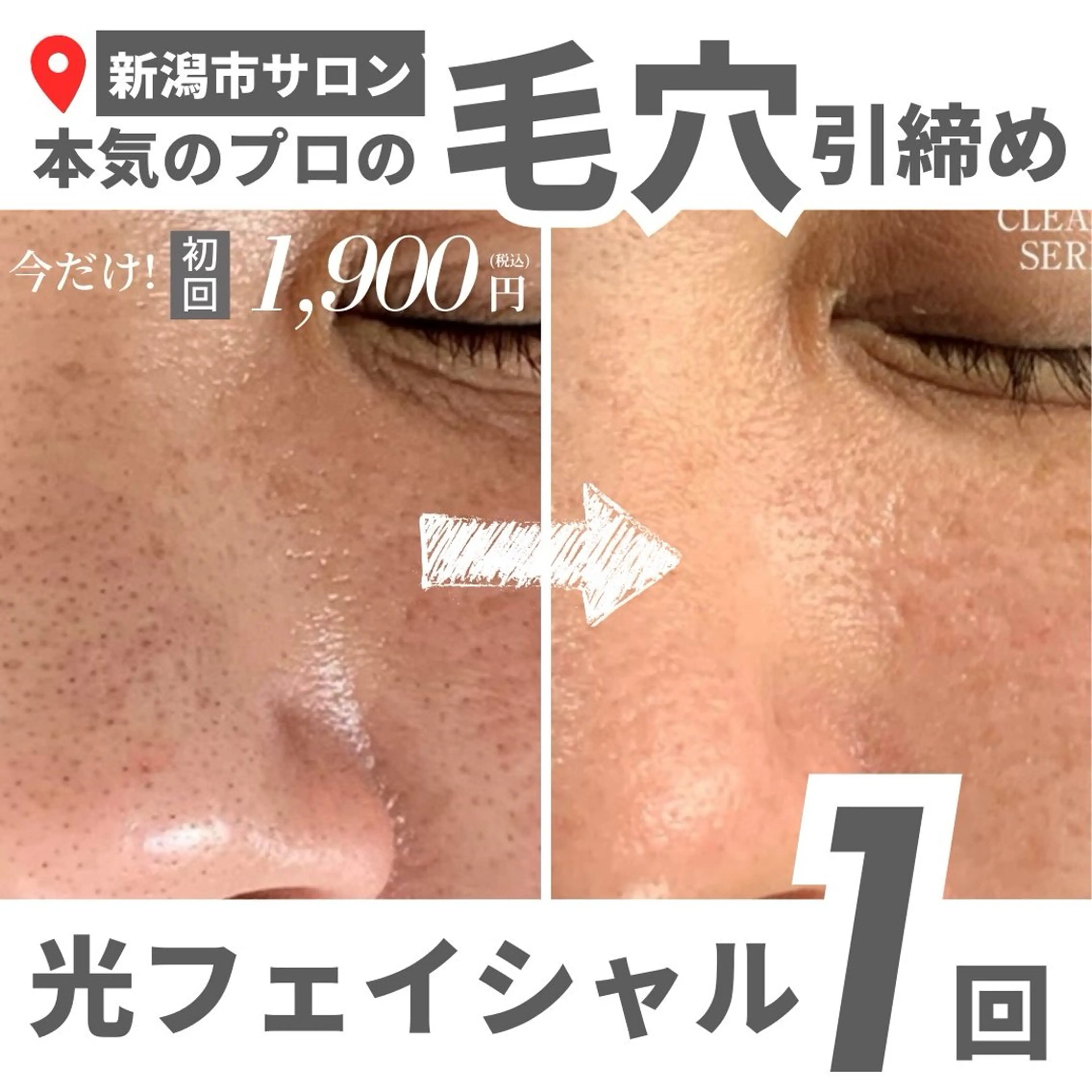 メンズ 有人型セルフサロン 脱毛／痩身／美顔のエステ・リラクイメージ