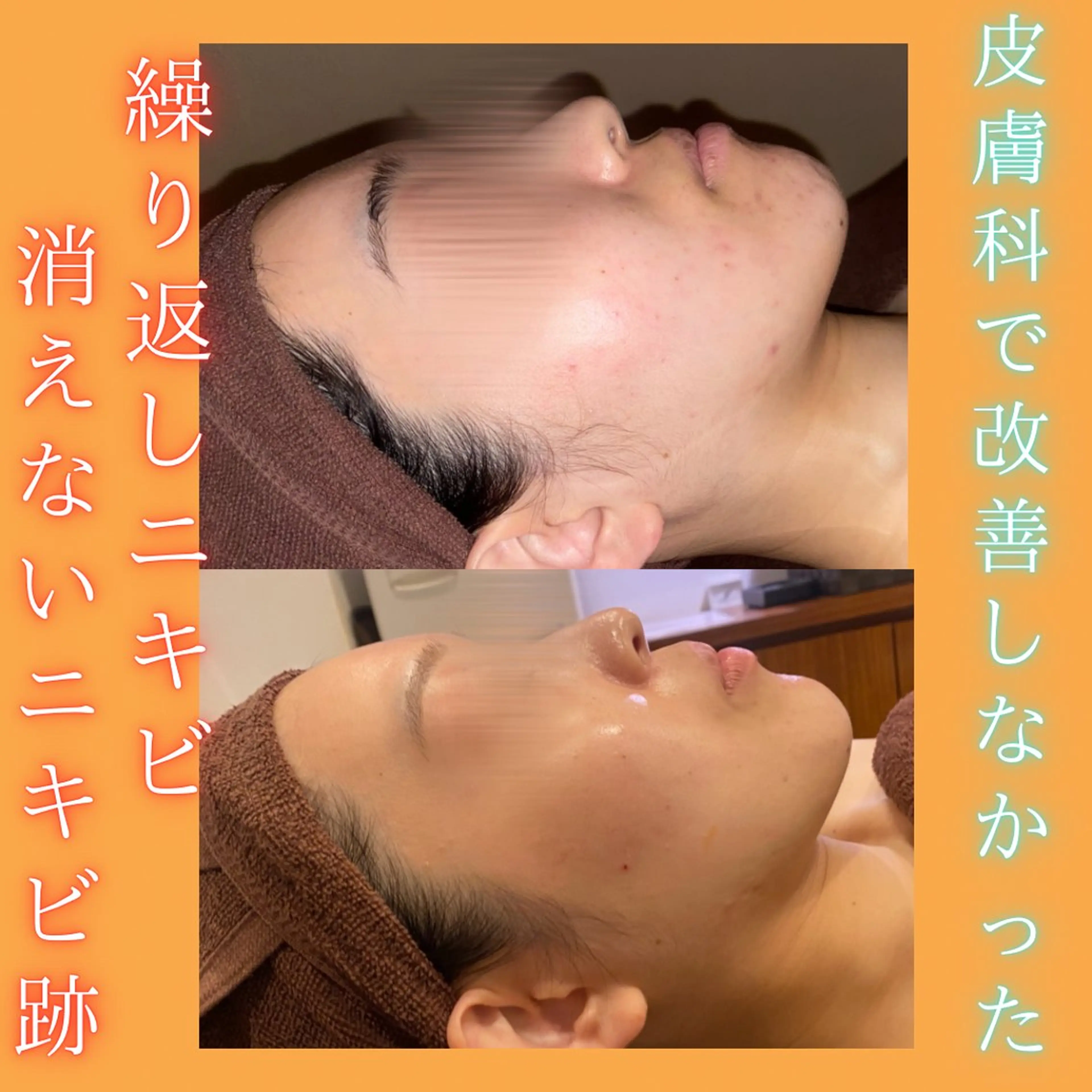 【相談から始める肌育✨】メニューでお悩みの方はこちらから💁‍♀️お肌にピッタリなコースをご紹介させて頂きます❣️の写真