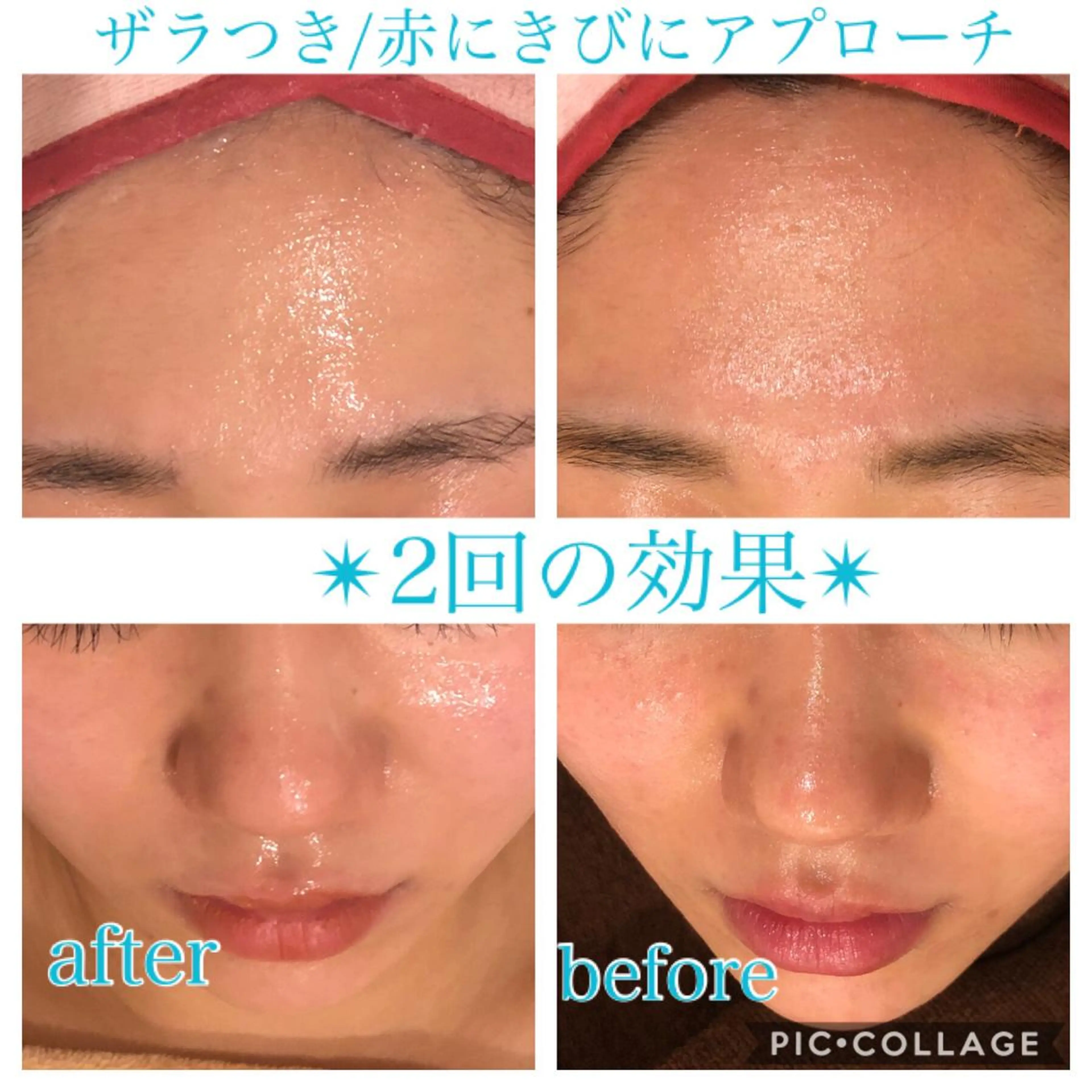 ロング カラー パーマ ヘアアレンジ キッズ ネイル マツエク・マツパ エステ リラク Ensor Clair所属・EnsorClair 代表 野口真央のエステ・リラクイメージ