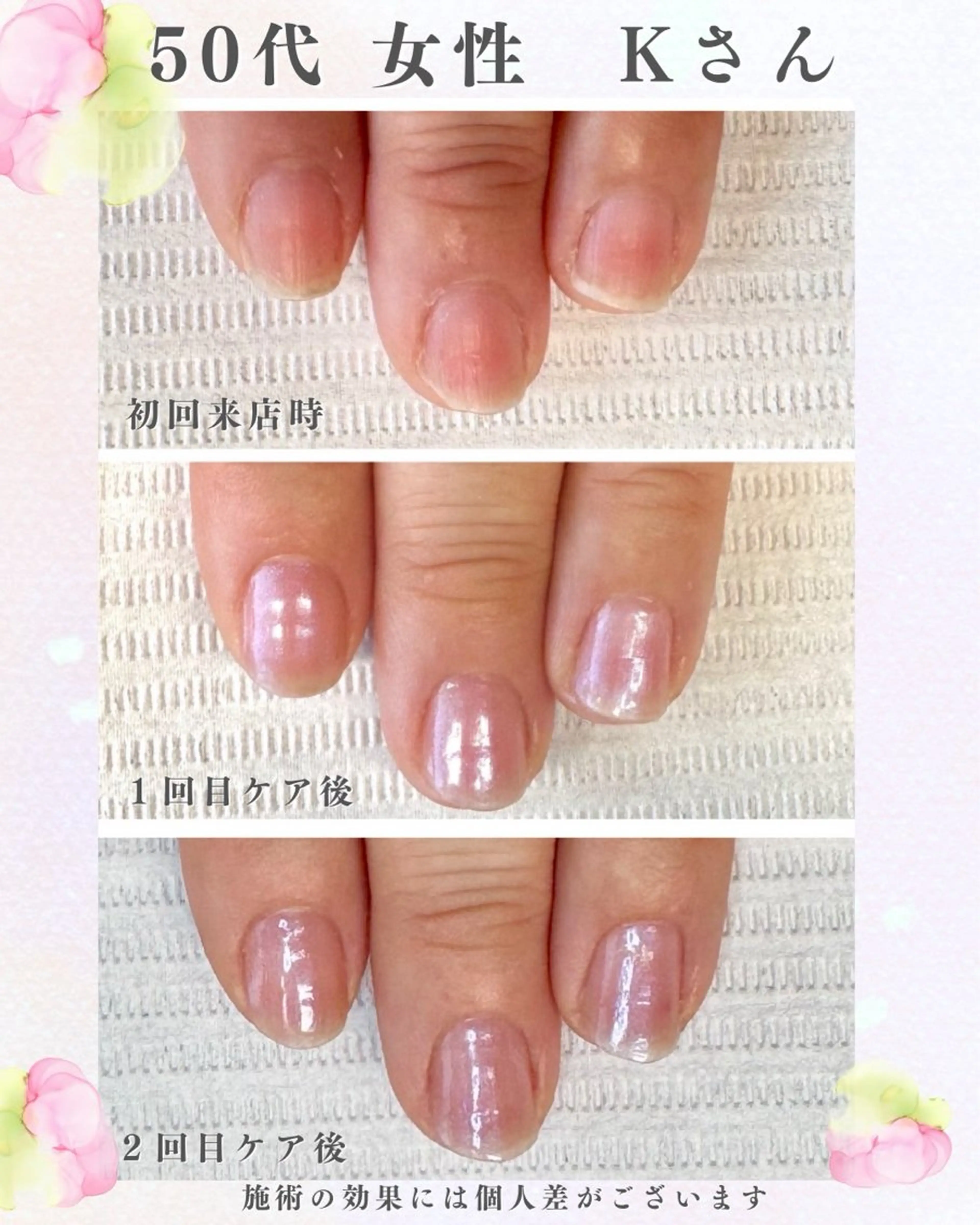 ネイル ハンドケア nail salon en所属・【自爪育成】nail salon enのネイルデザイン