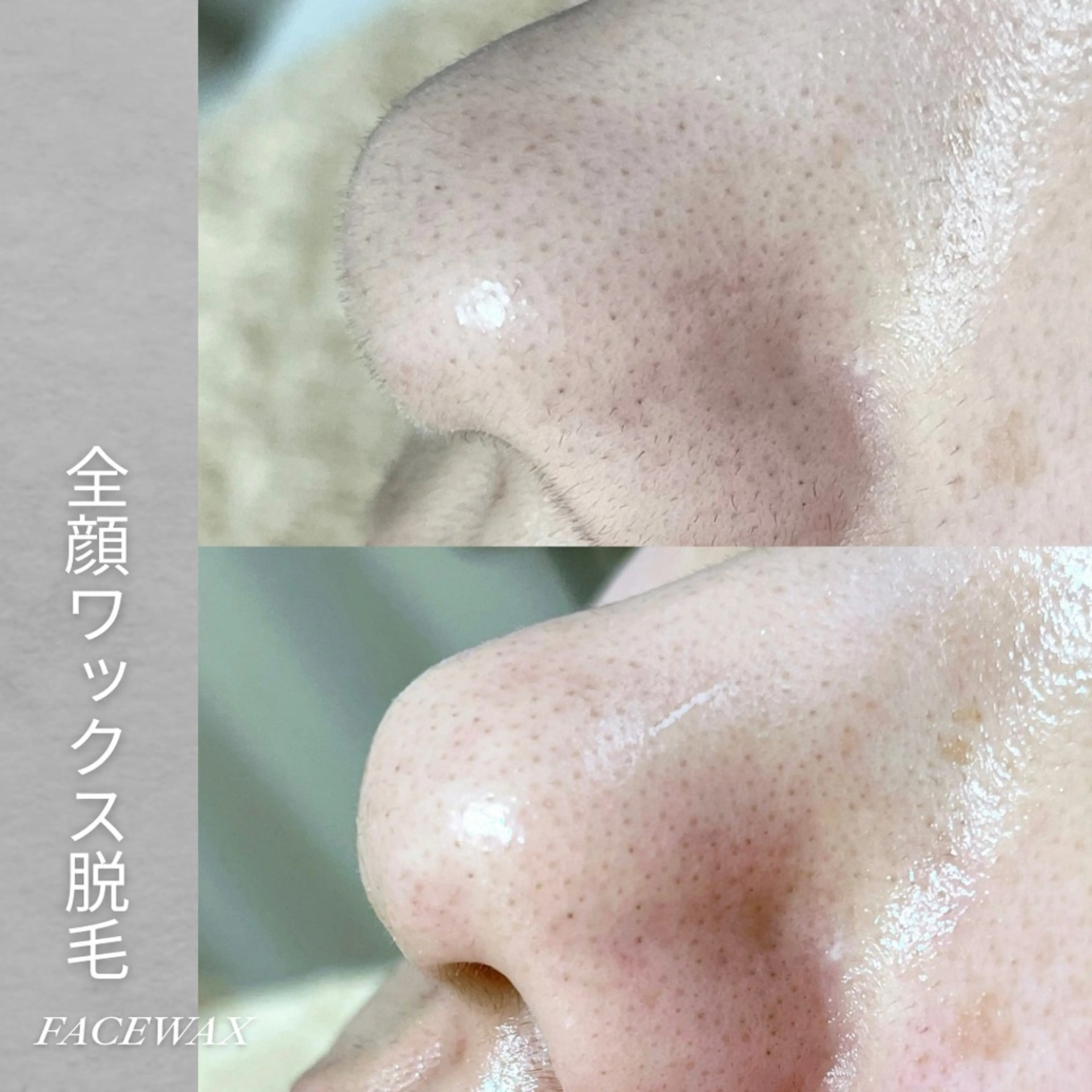 EST BEAUTY所属・顔ワックス脱毛/ ハーブピーリングのエステ・リラクイメージ