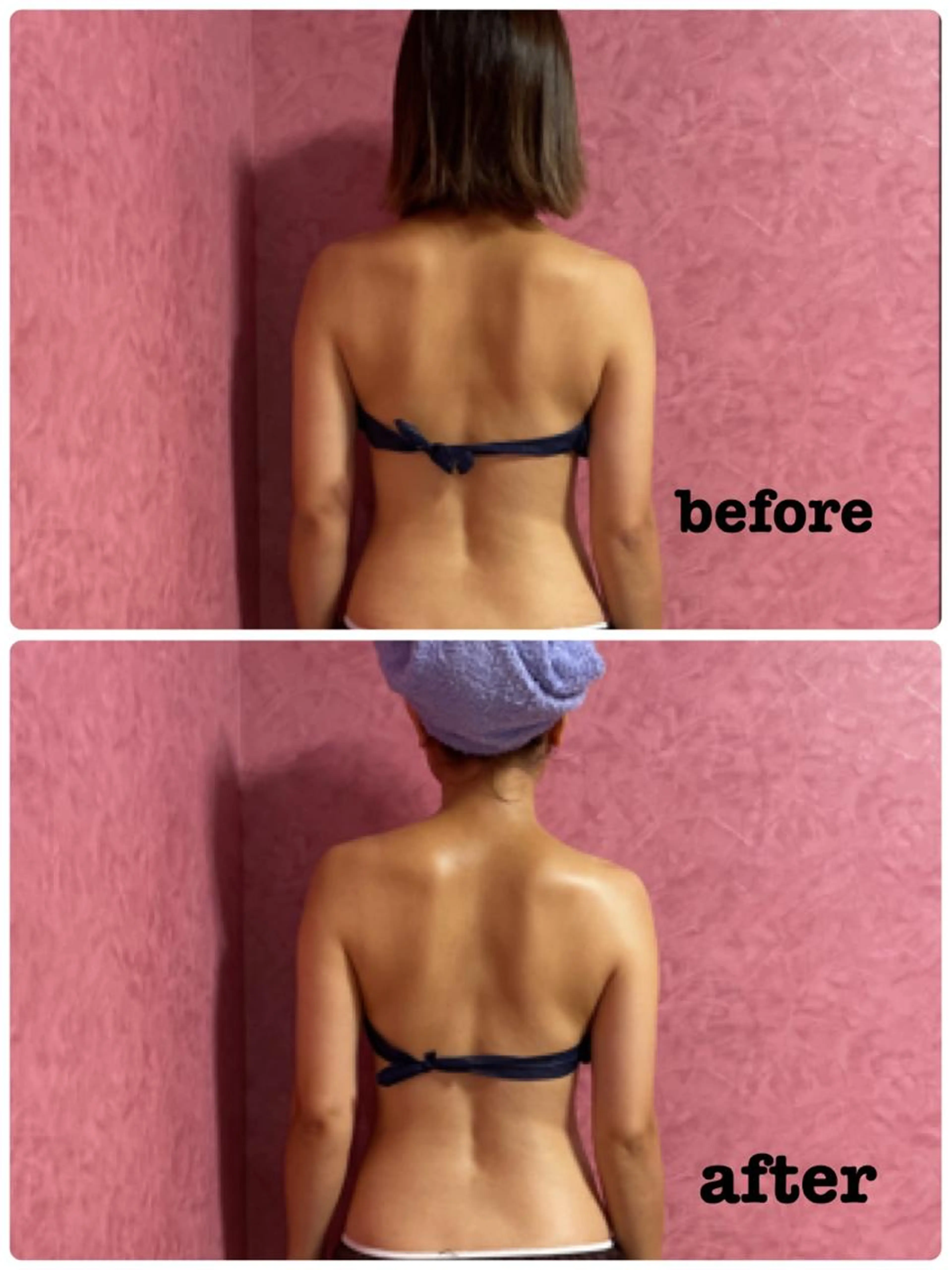 ハイパーナイフ×ハイパーシェイプ半身🔥¥16,500→¥8,980口コミ投稿写真OKな方の写真