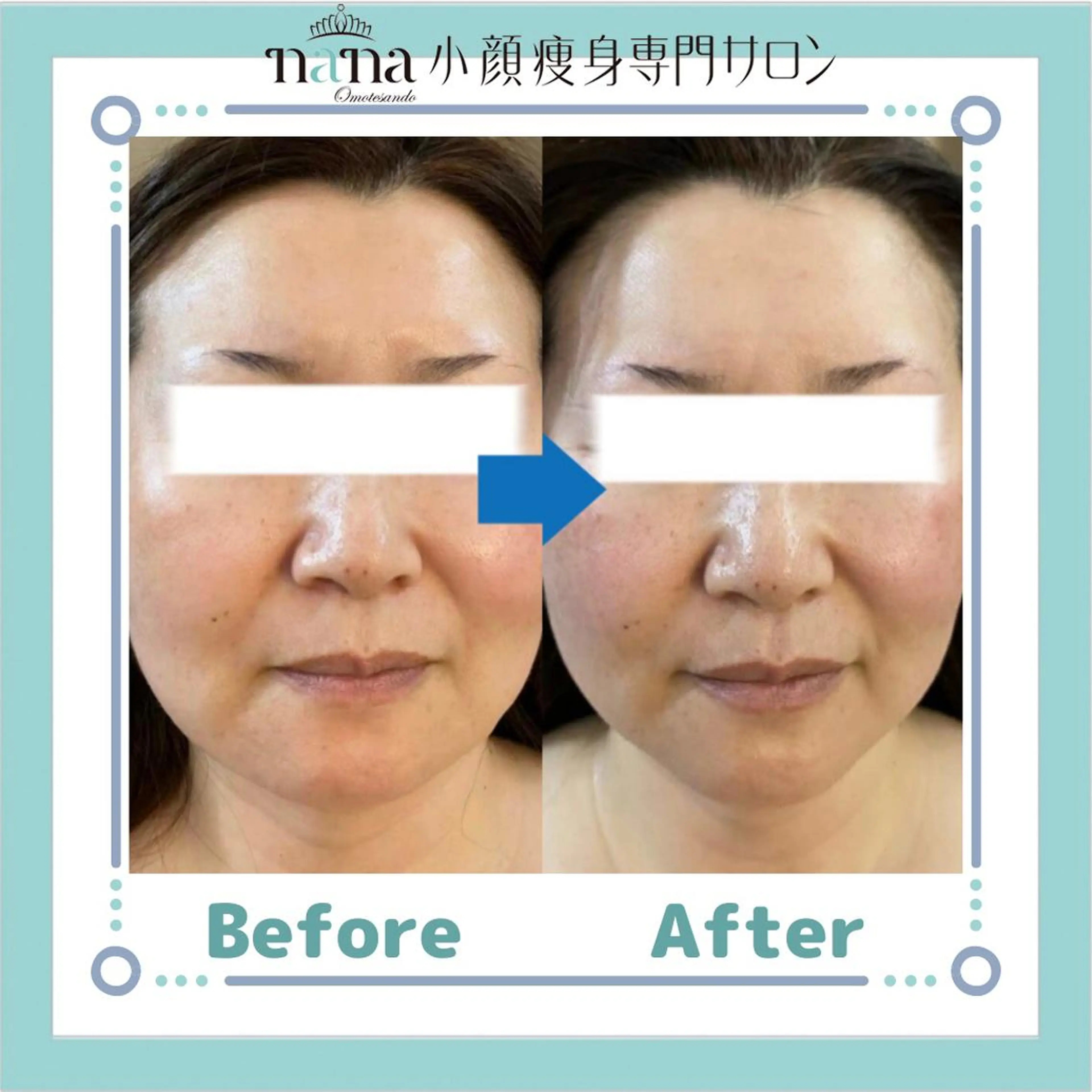 小顔痩身インディバ Nana表参道のエステ・リラクイメージ