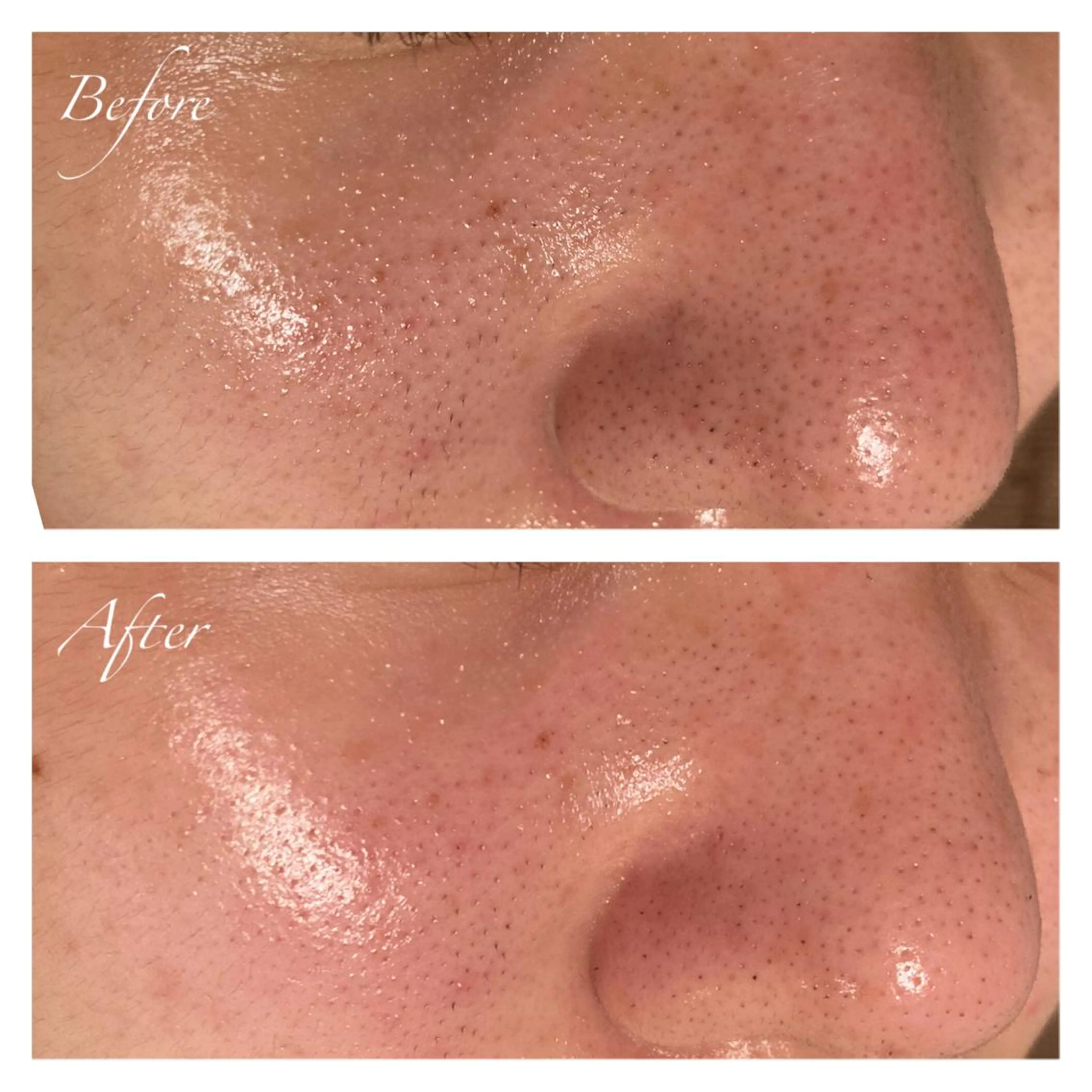 アイブロウ ワックス脱毛 眉カット その他(アイブロウ) Ｂ&H所属・頭痛•肩こり専門/ 眉サロンB&H心斎橋のエステ・リラクイメージ