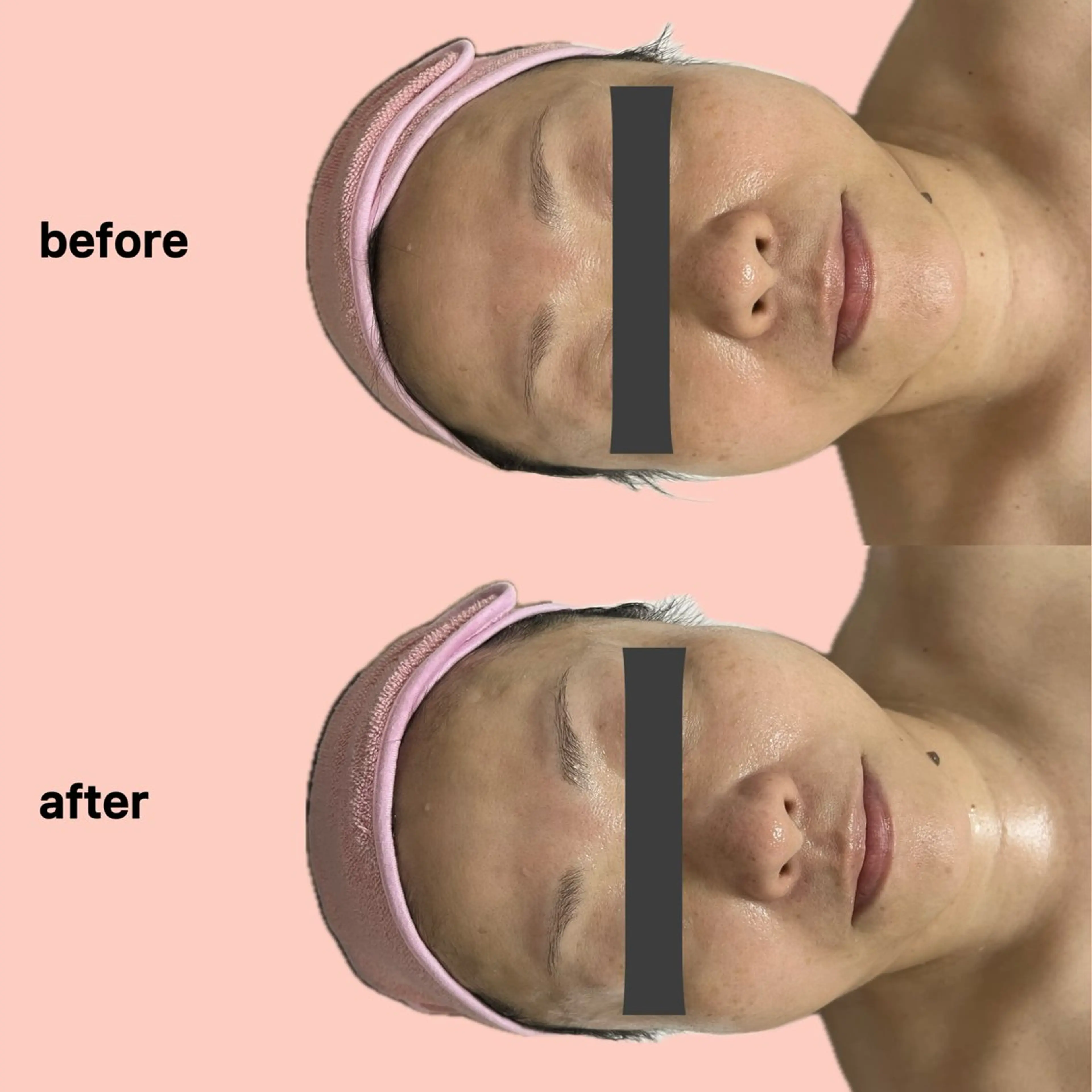 エステ gleam ü 枚方公園のエステ・リラクイメージ