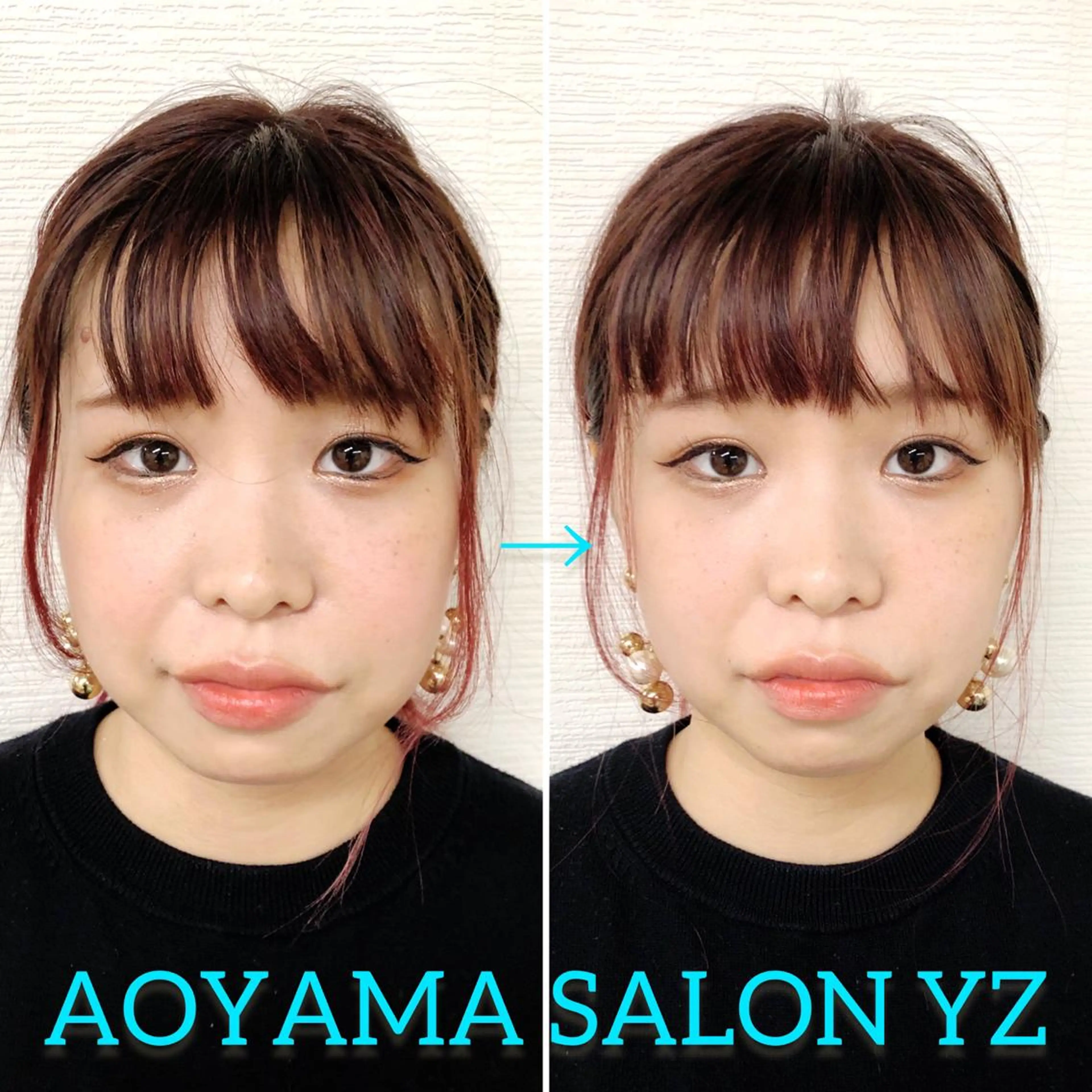エステ リラク 小顔美容鍼専門サロン 渋谷YZのエステ・リラクイメージ