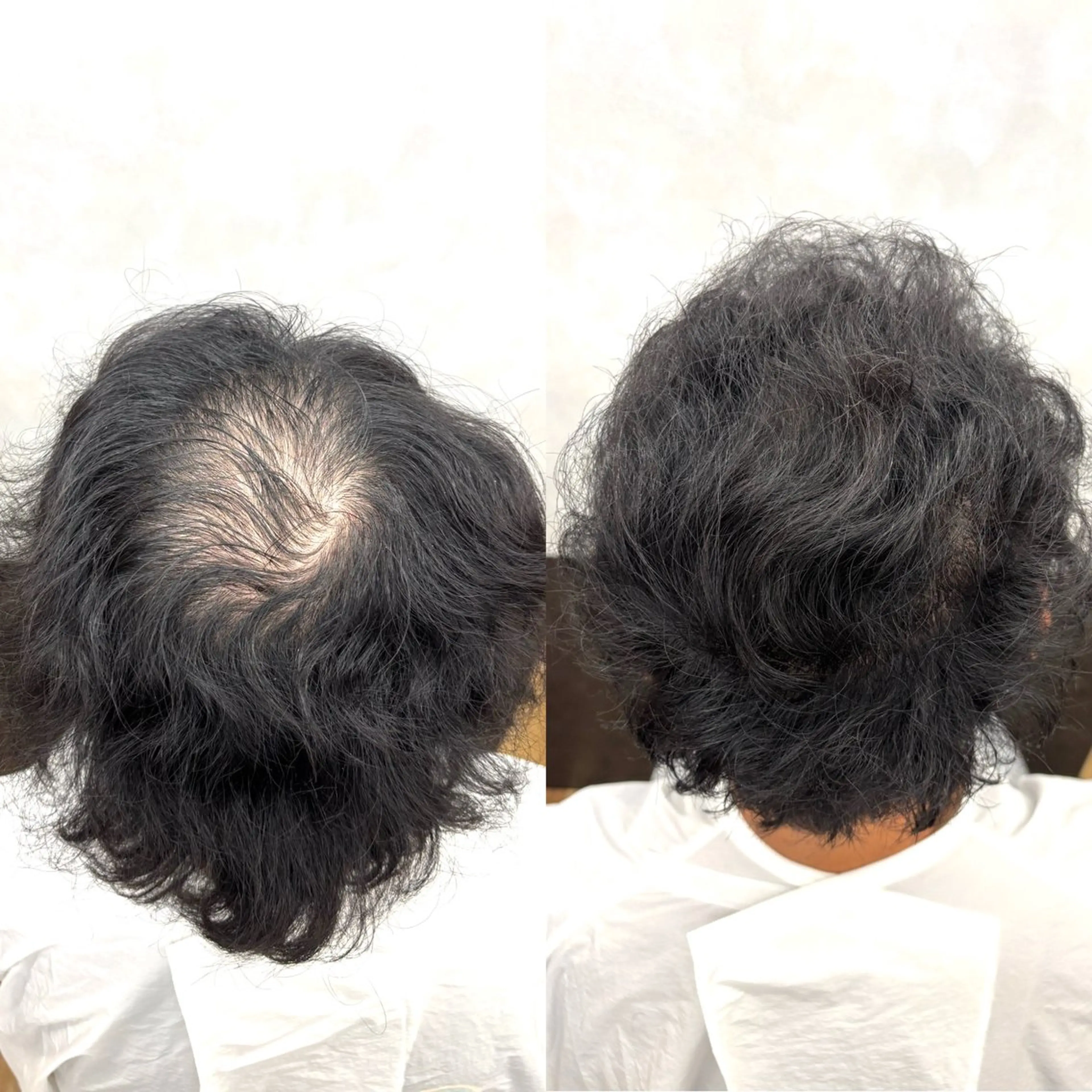 メンズ 薄毛専門美容師 和久井博のその他イメージ