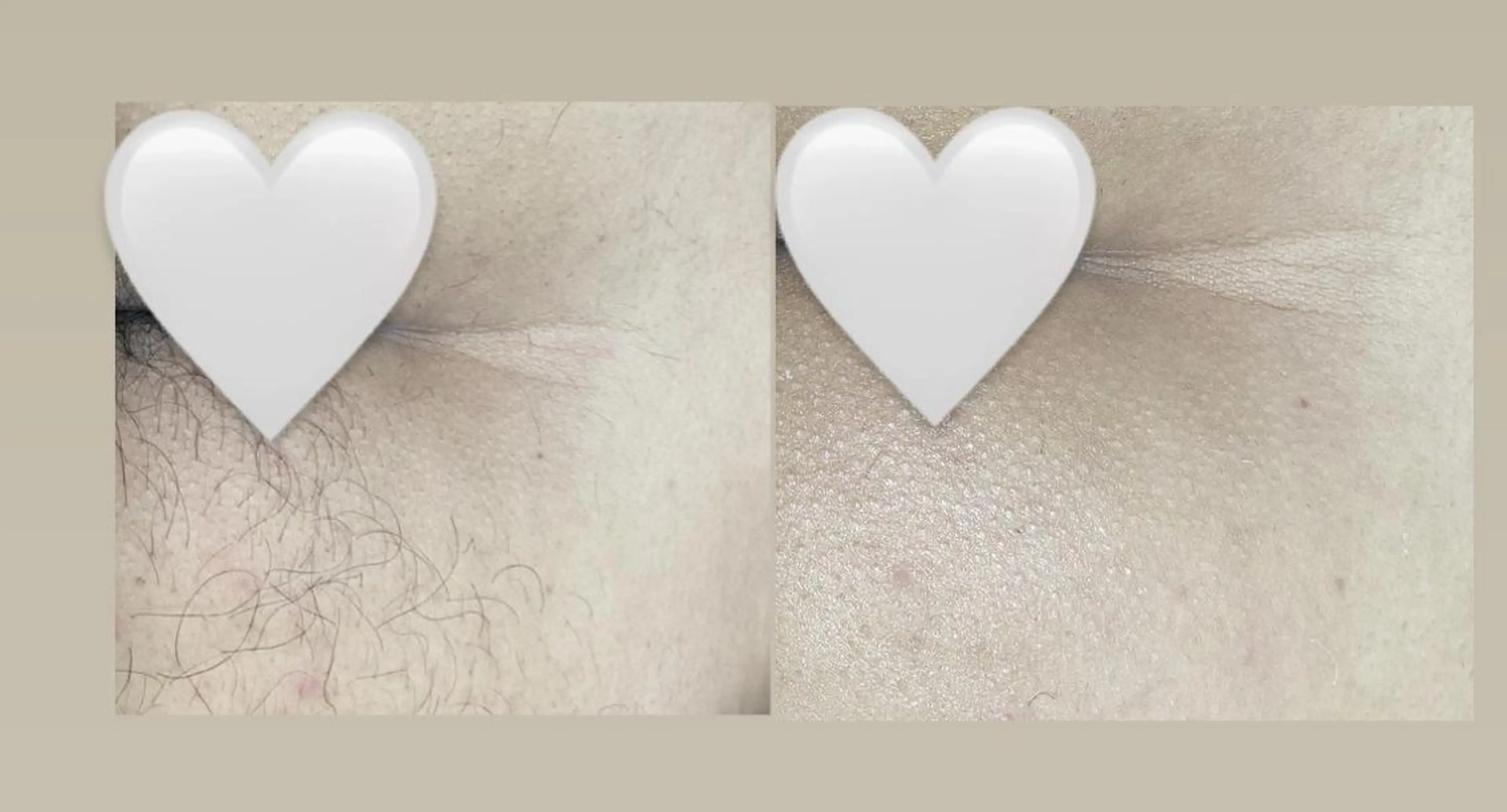 脱毛 Epina 千葉店 【エピナ】のエステ・リラクイメージ