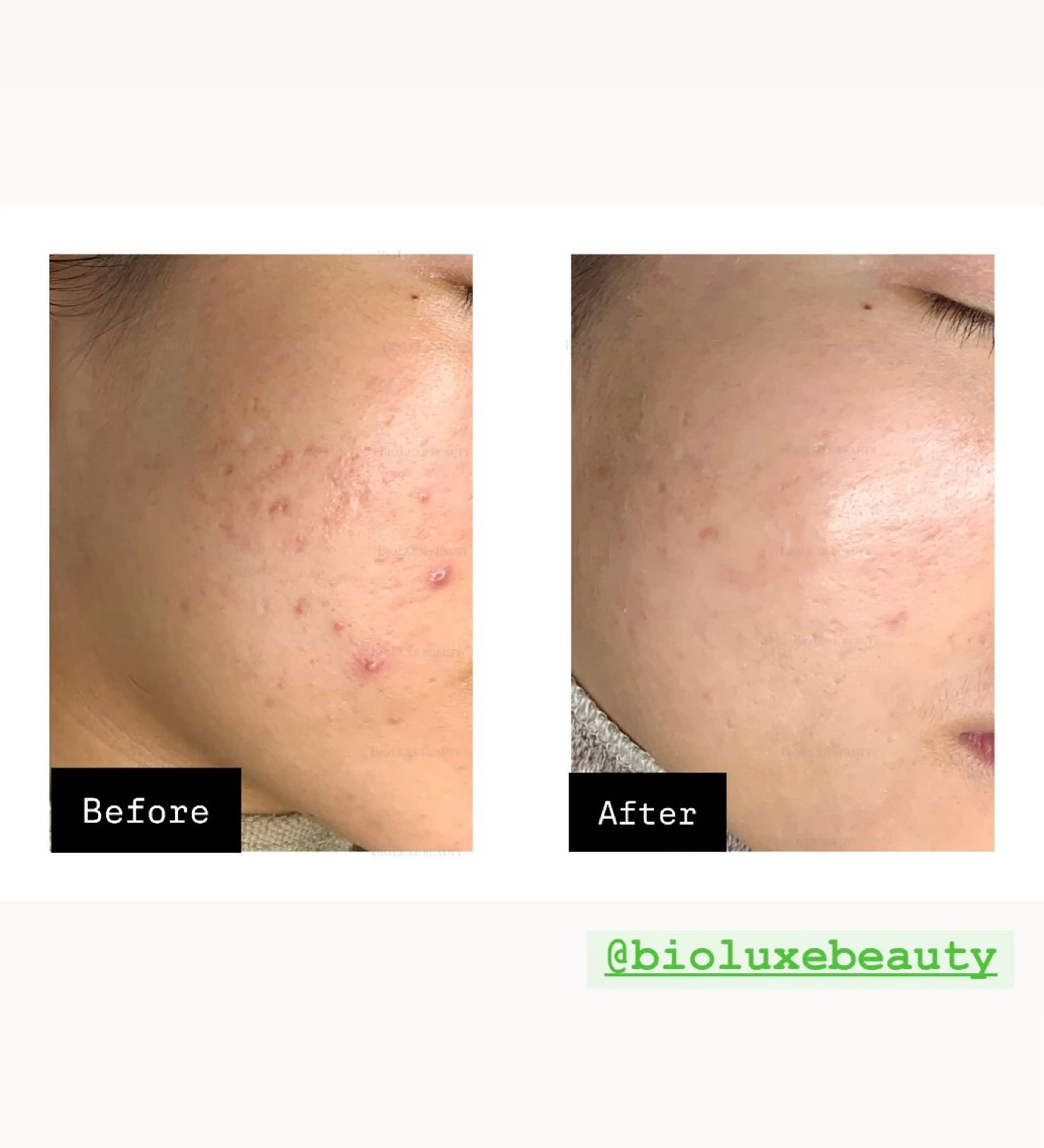 BIOLUXE BEAUTY所属・バイオラックス ビューティーのエステ・リラクイメージ