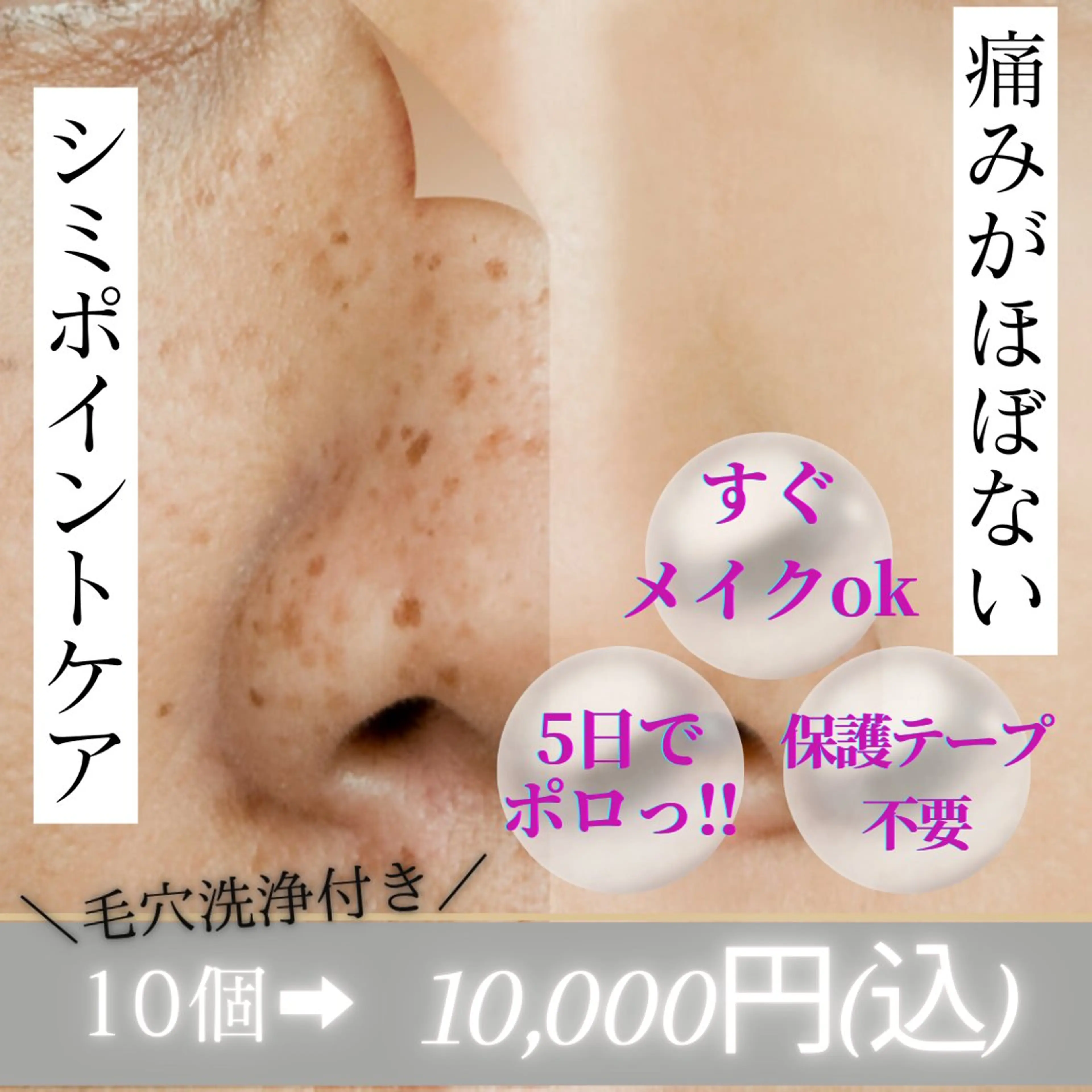 【少なめの方に◎】お手軽シミケア/毛穴洗浄×シミケア(10個まで)約40分の写真