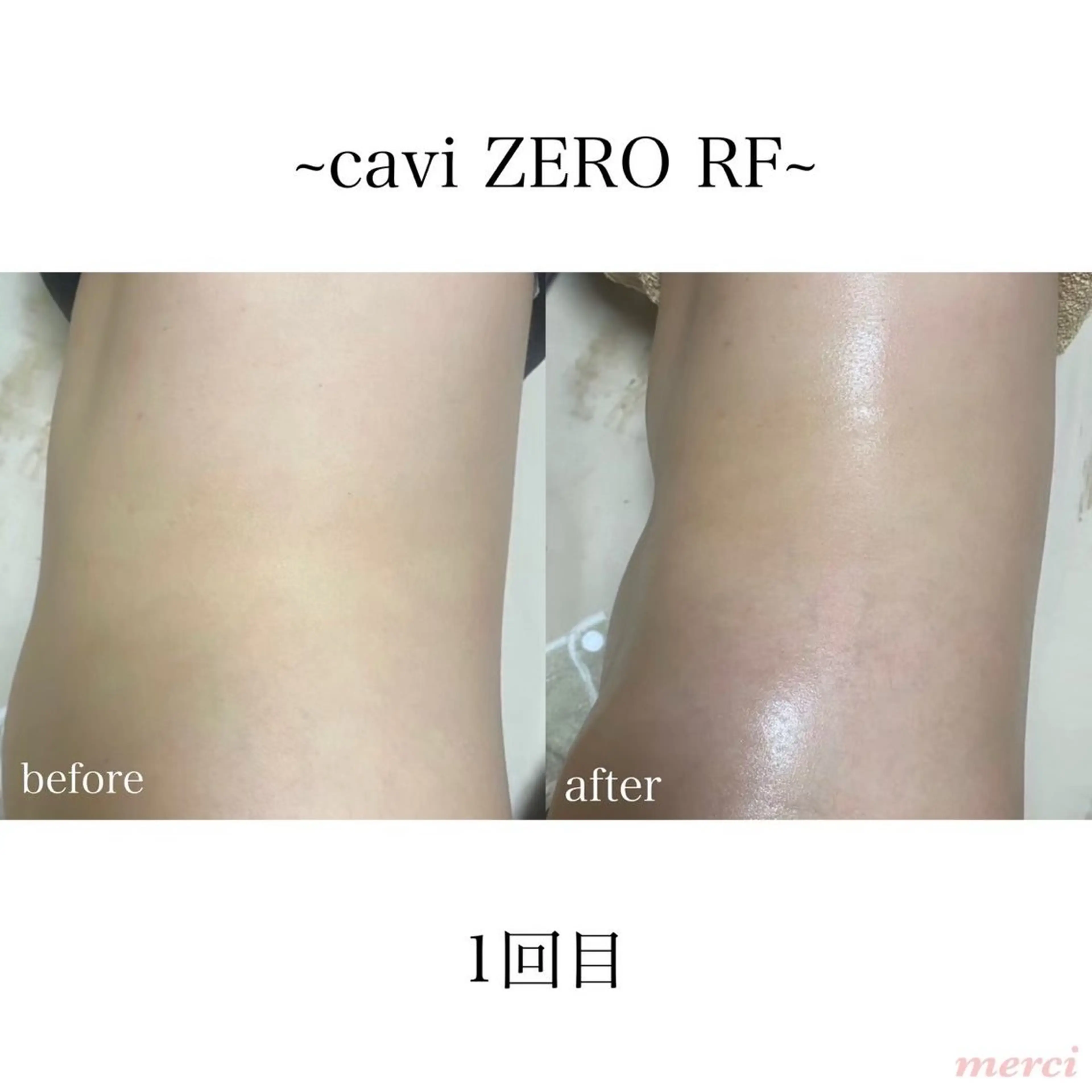 salon merciのエステ・リラクイメージ