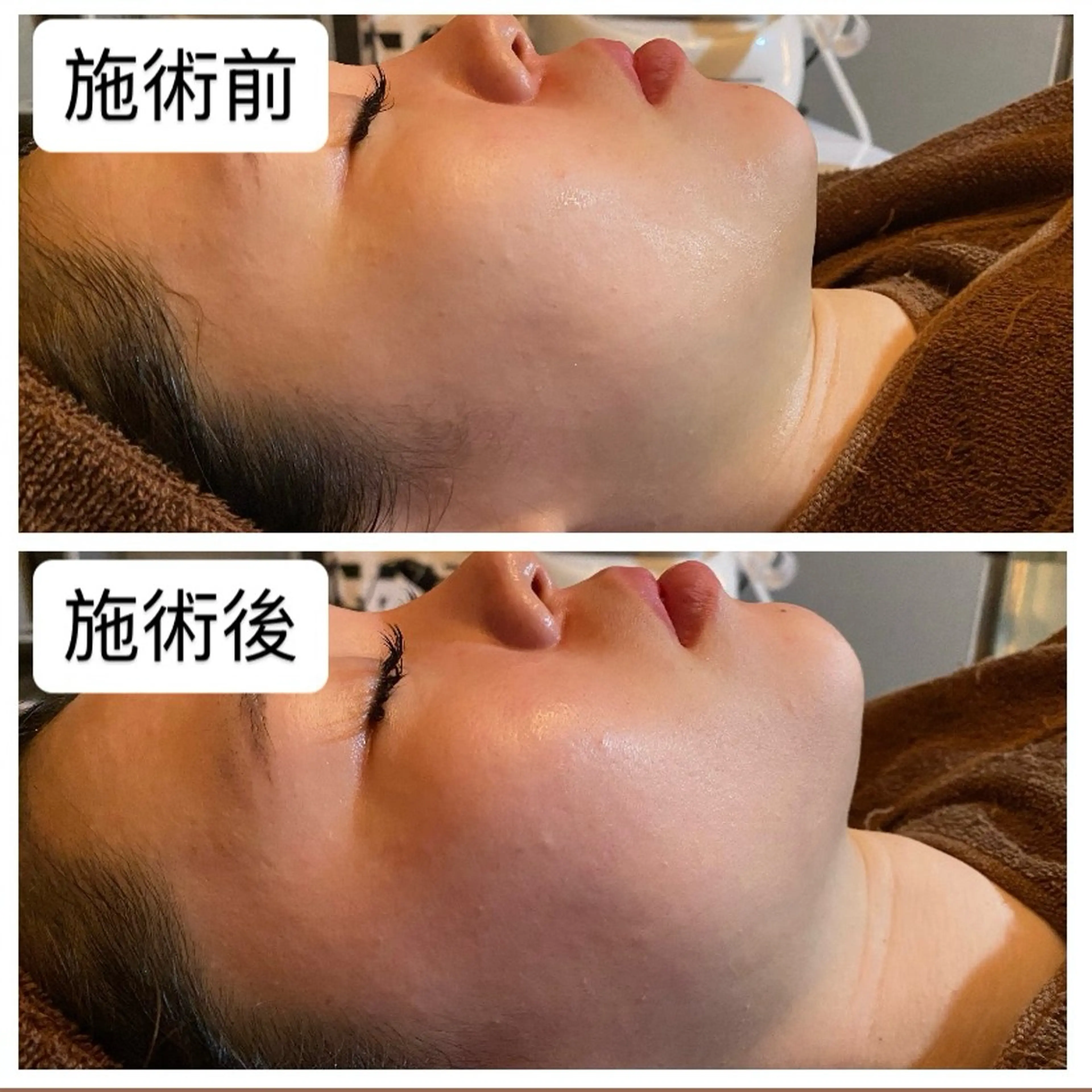 エステ 肌質改善専門 ハーブ /毛穴洗浄 リエイトのエステ・リラクイメージ