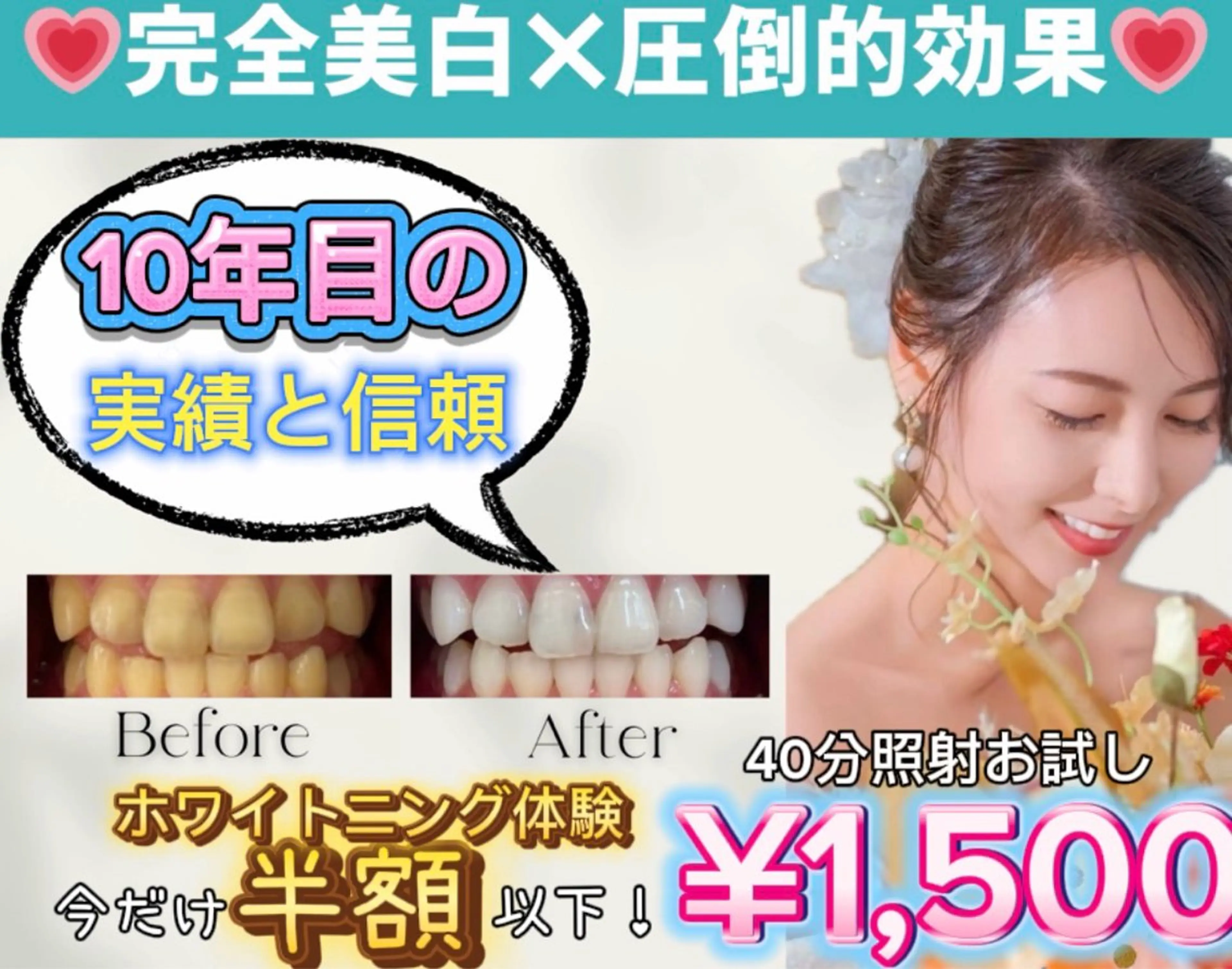【いい歯の日🦷】大好評のため期間延長✨️美白セルフホワイトニング たっぷり40分照射¥7,980⇒¥1,500の写真