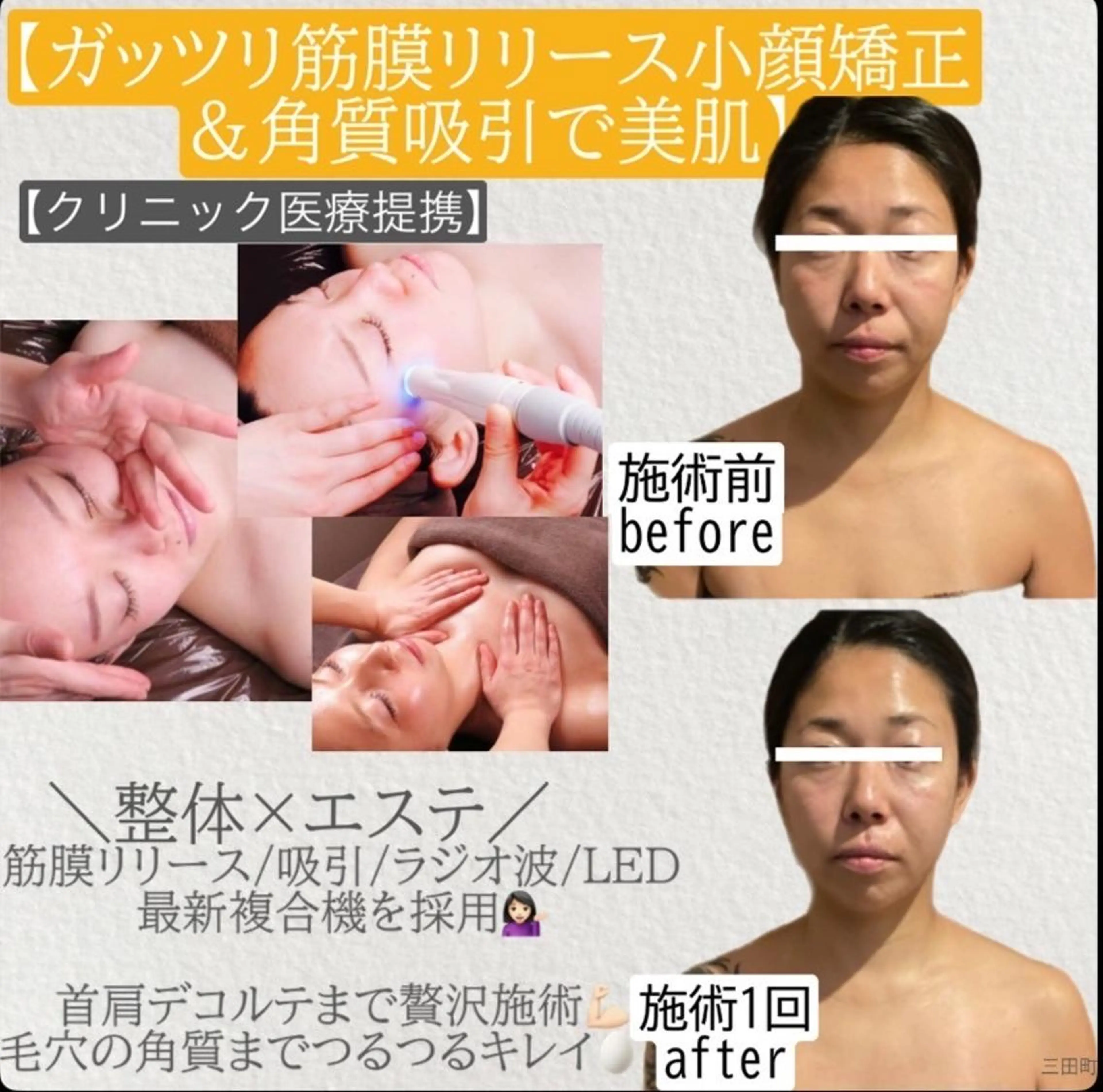 🌟成人式応援クーポン🌟新成人応援📣成人式前のスペシャル小顔ケア💆‍♀️の写真