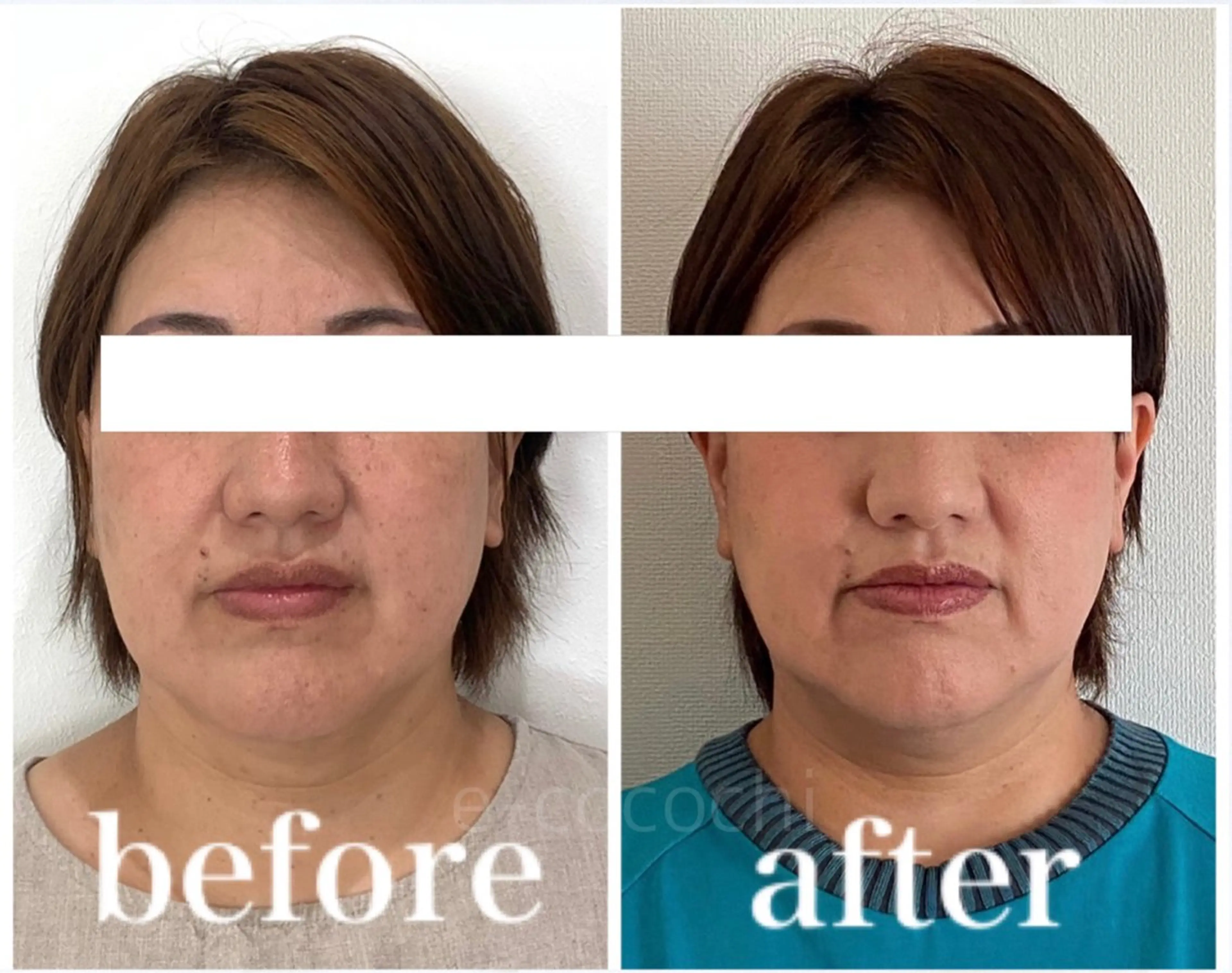 エステ リラク 小顔と ヘッドスパのお店のエステ・リラクイメージ