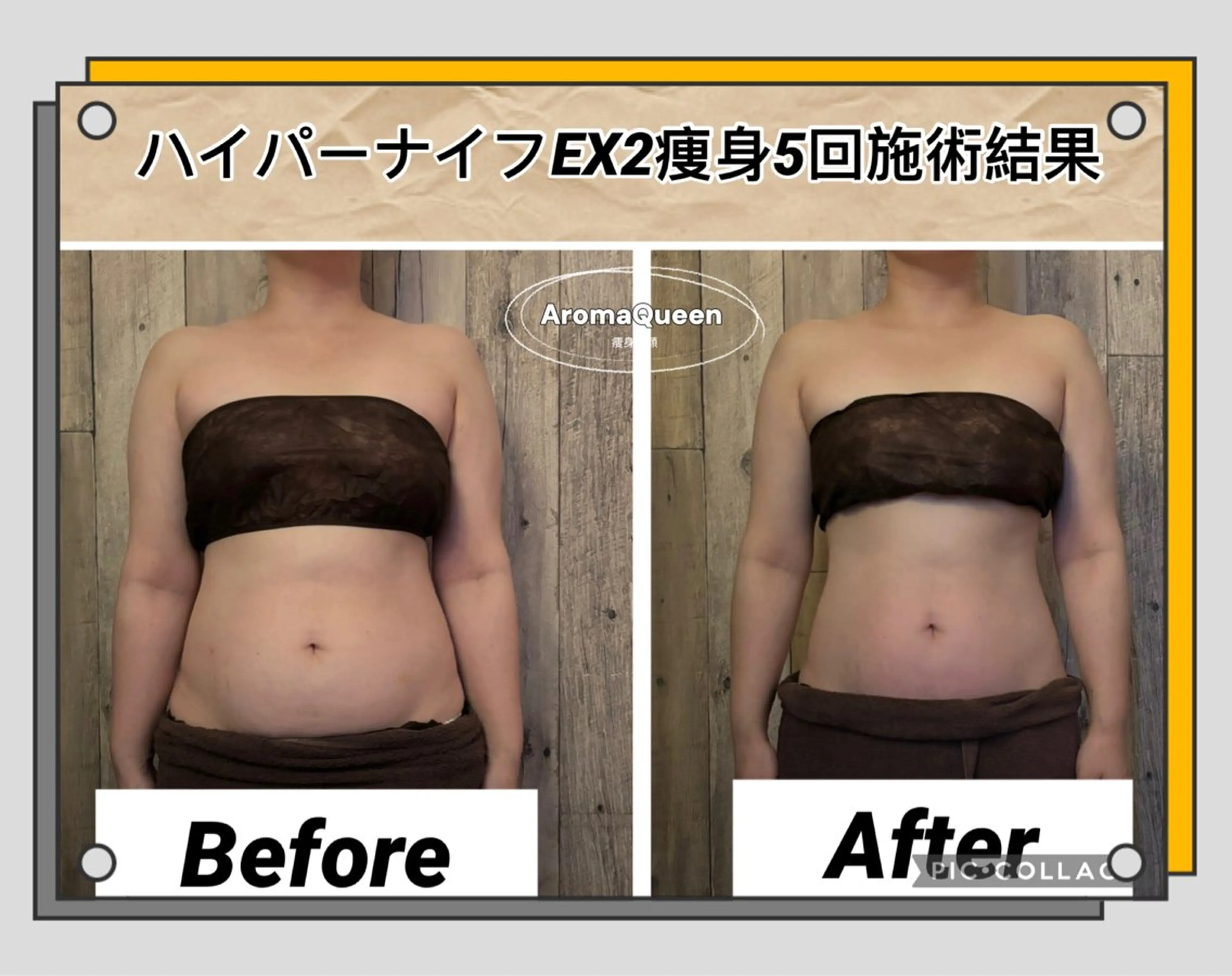 アロマクイーン所属・所沢痩身小顔コルギ AromaQueenのエステ・リラクイメージ