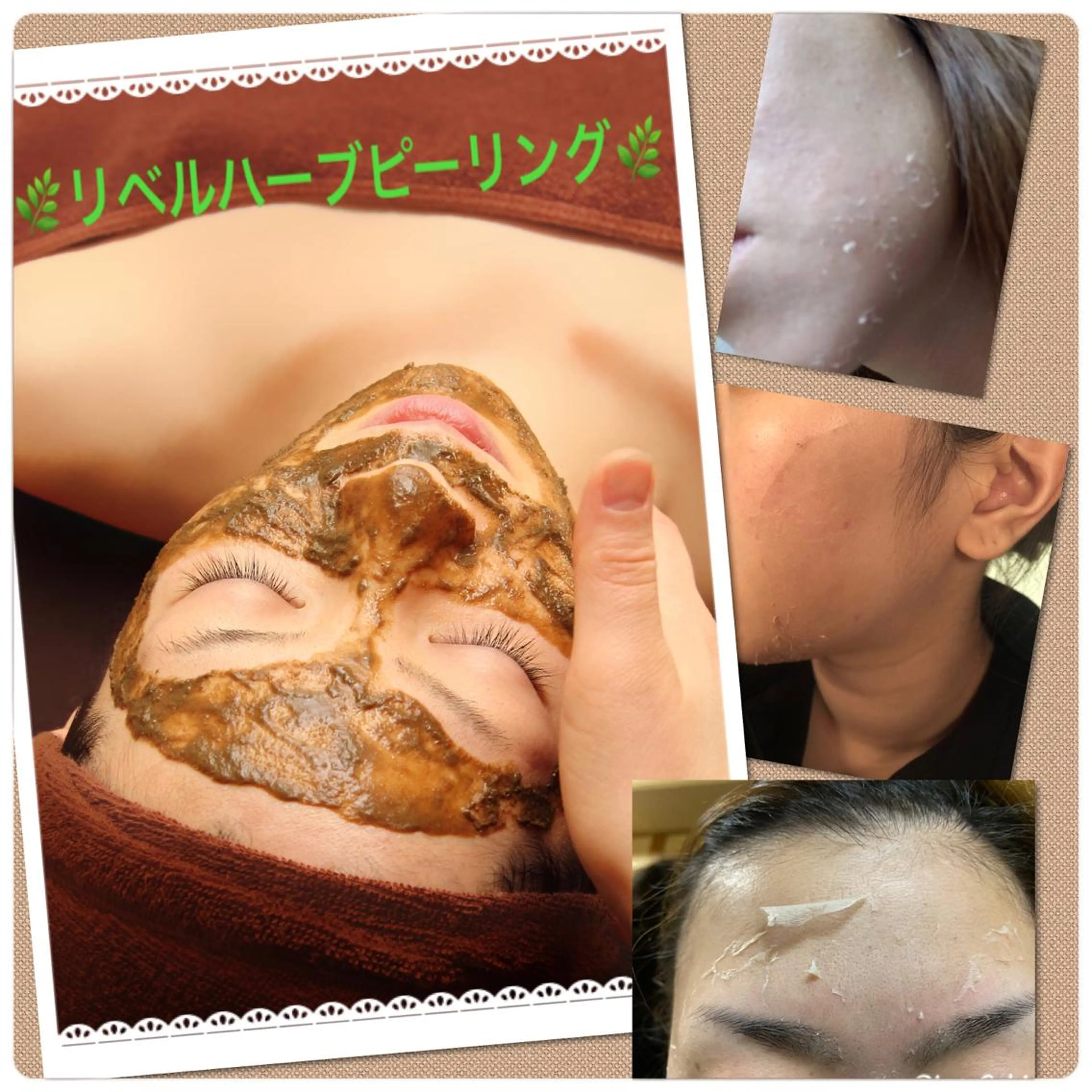 エステ 【リベルハーブピーリング認定店】敏感肌・美白脱毛専門店Dione立川店所属・Dione 立川店のエステ・リラクイメージ