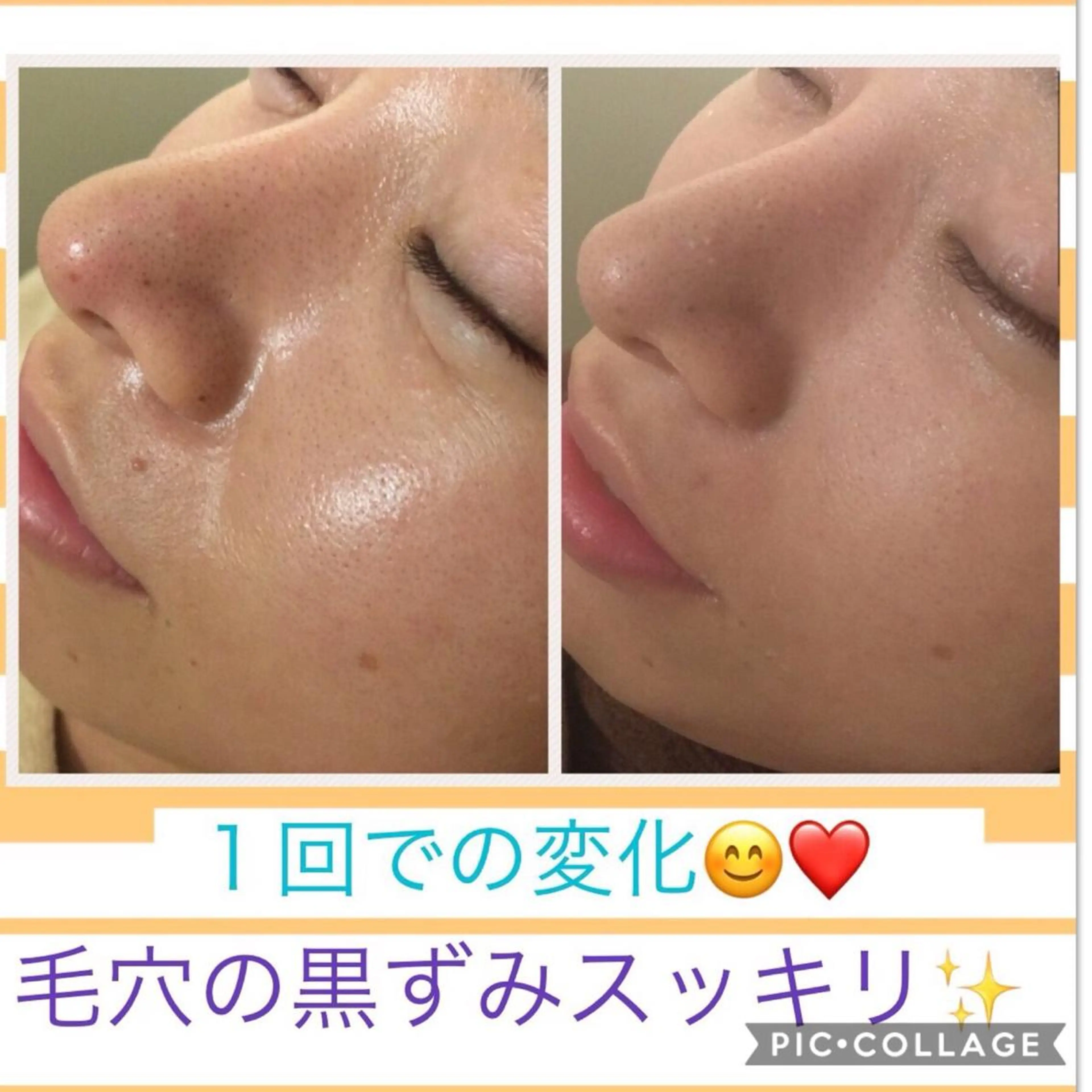 ミディアム カラー パーマ ヘアアレンジ メンズ キッズ ネイル マツエク・マツパ アクール　齋藤 ♡肌トラブル卒業のエステ・リラクイメージ