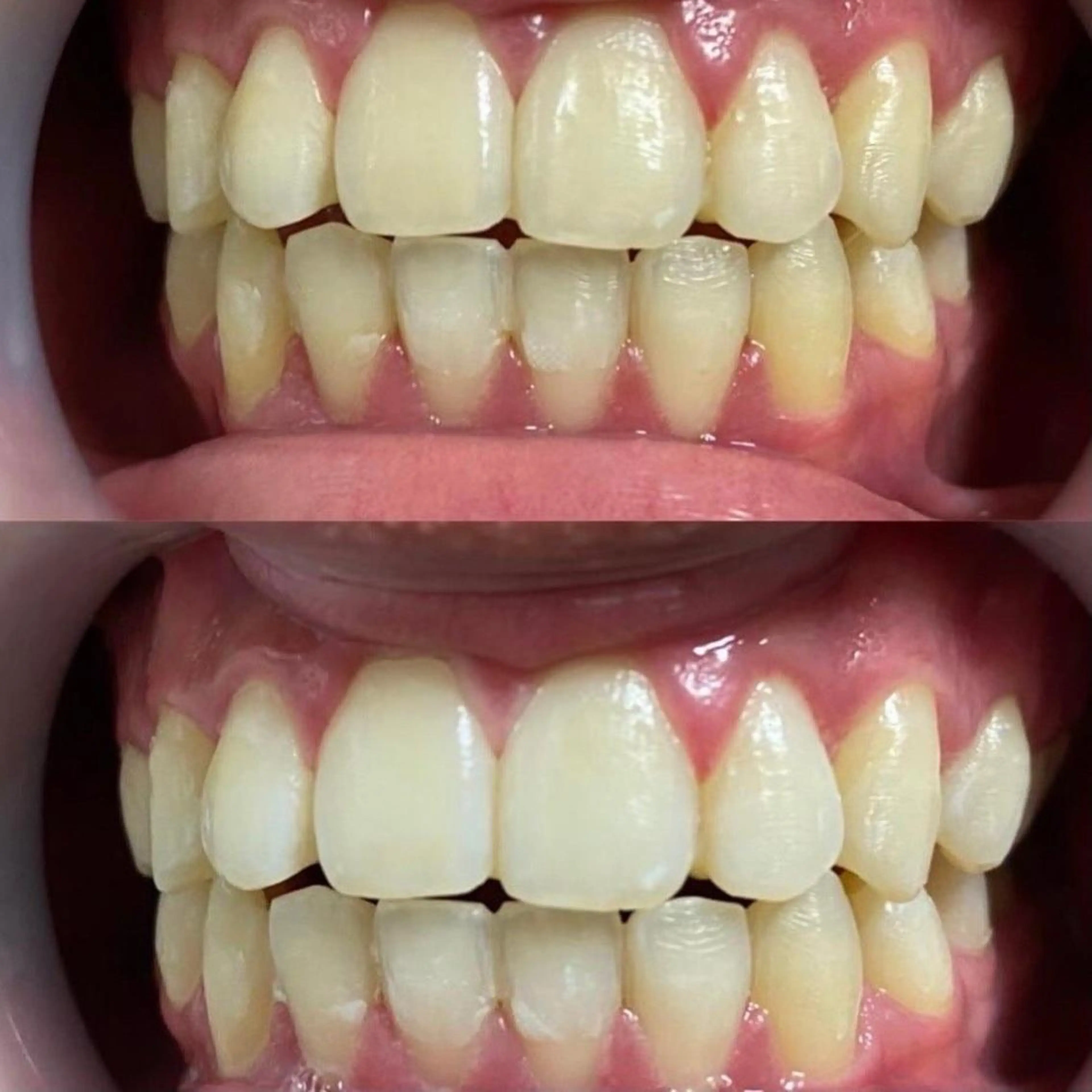 セミロング カラー パーマ ヘアアレンジ ネイル マツエク・マツパ アイブロウ ホワイト LBSホワイトニング 🩵梅田店公式のエステ・リラクイメージ