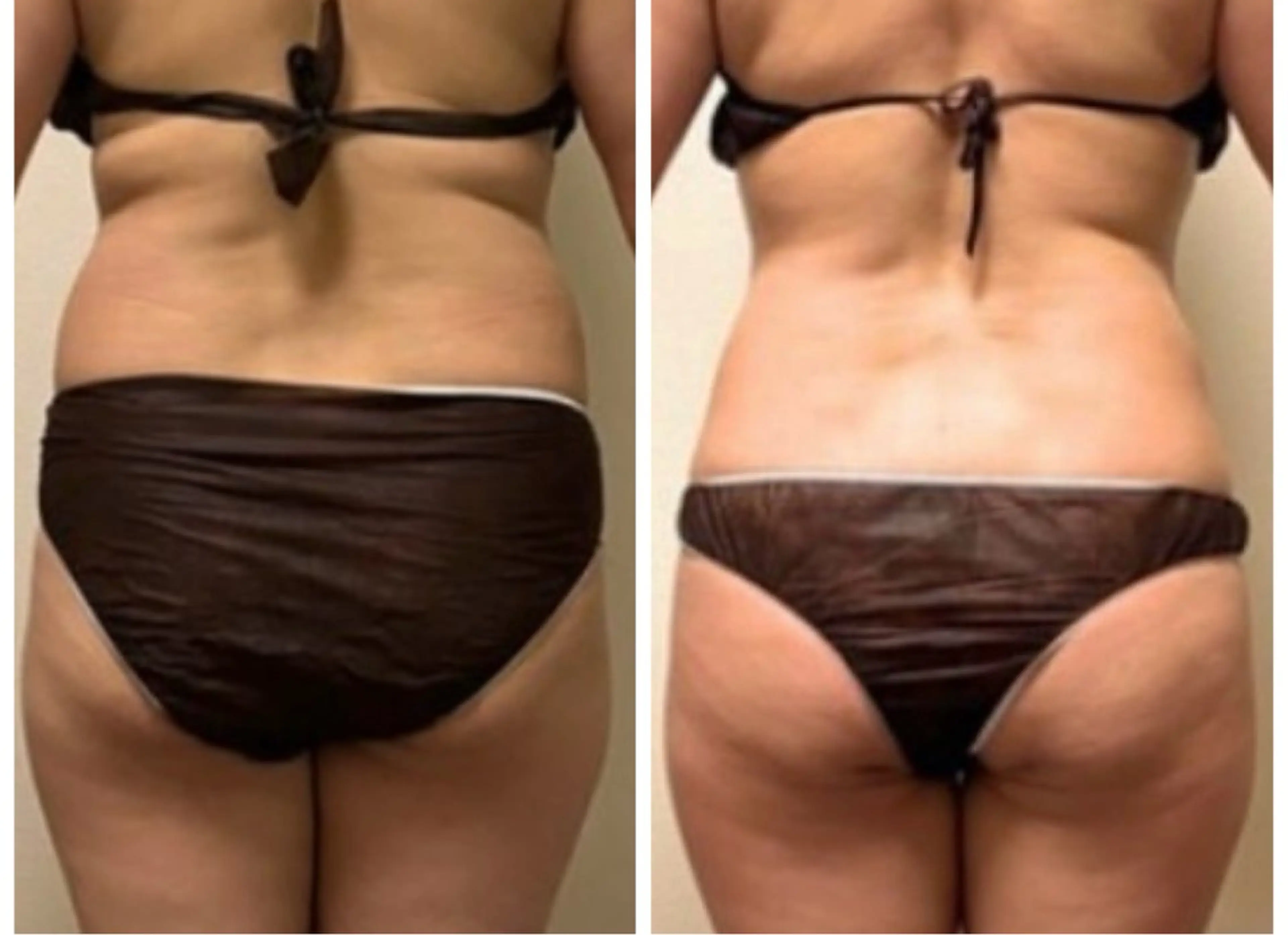 Xmas特典🎁極上の痩身体験/頭痛/肩こり/腰痛/むくみ/半年で不調からの解放の写真