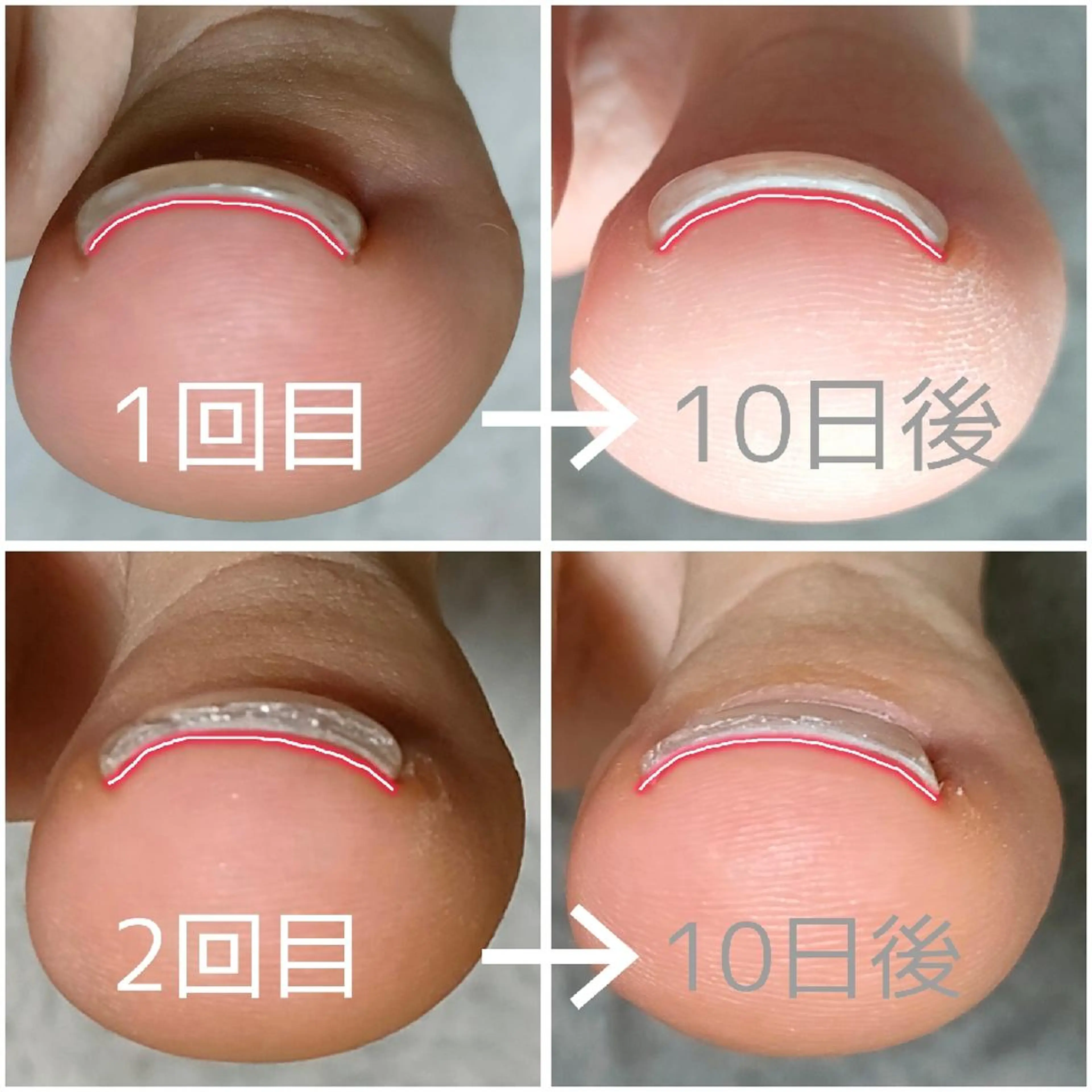 ネイル フットネイル Nail Salon   AO✳Emiのネイルデザイン