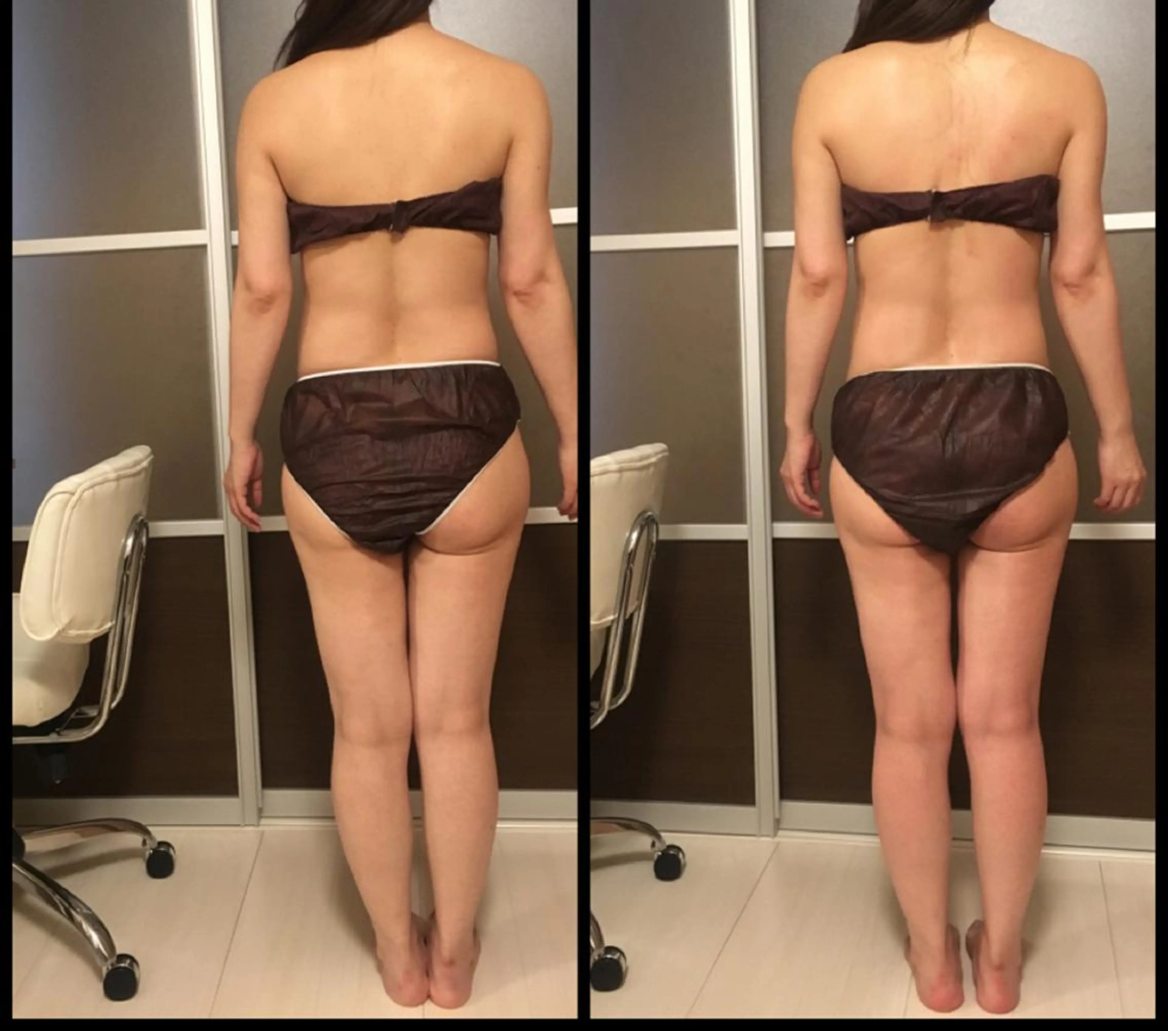 セミロング パーマ ヘアアレンジ キッズ ネイル マツエク・マツパ アニメ,Vオタク× 即効痩せエステサロンのエステ・リラクイメージ