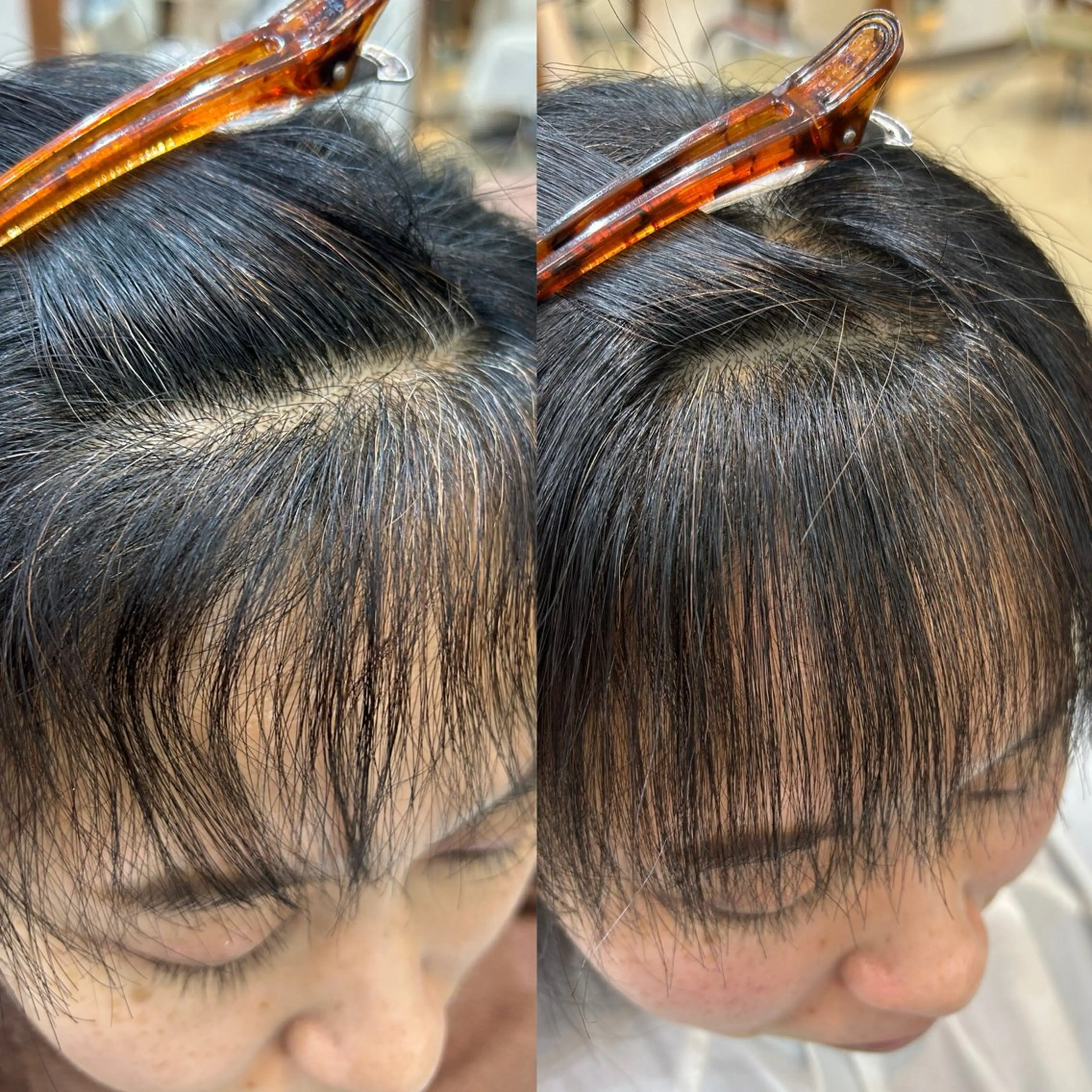 ✨前髪縮毛矯正+トリートメント✨の写真