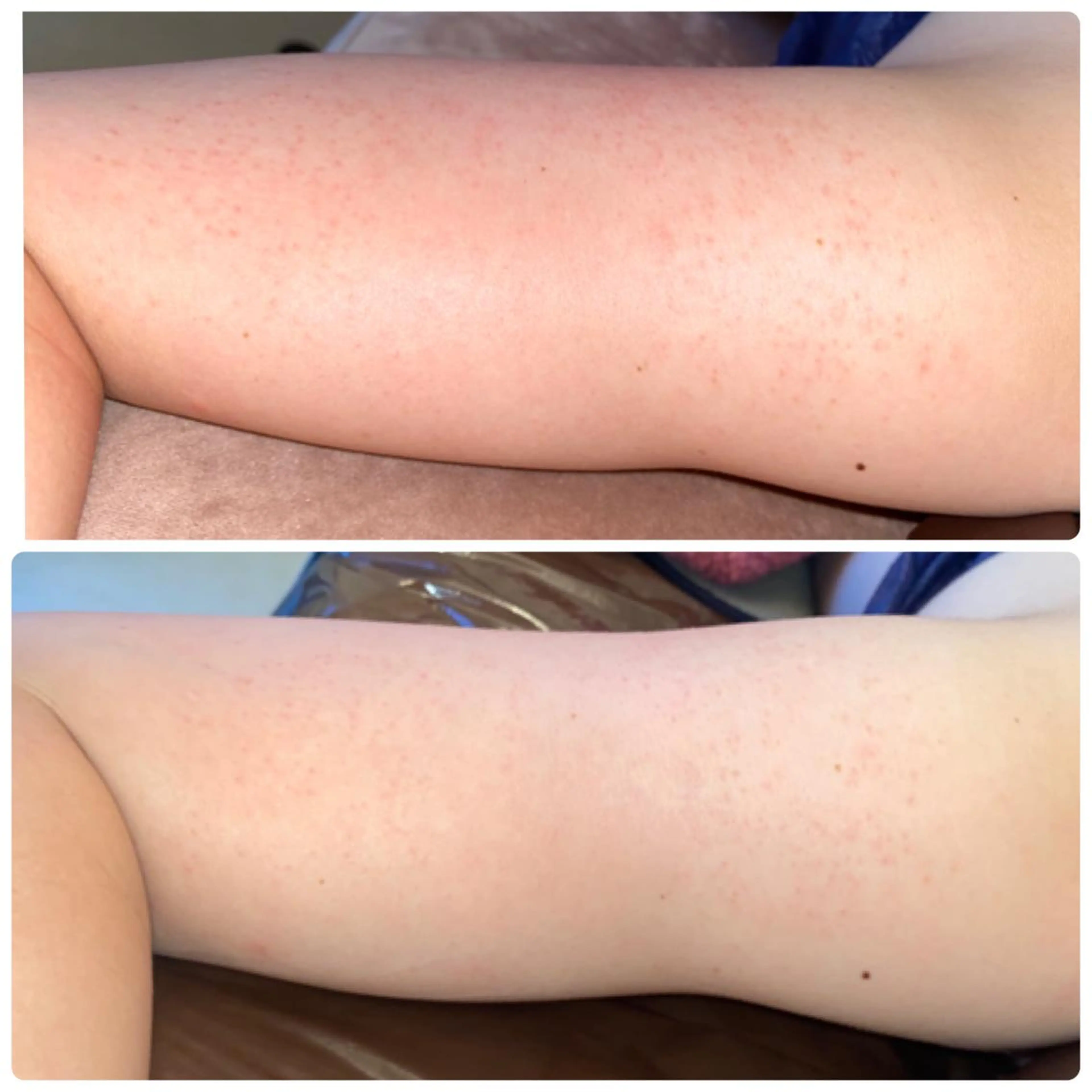 FLEUR大阪・整体 ・ハイフ・痩身・小顔のエステ・リラクイメージ