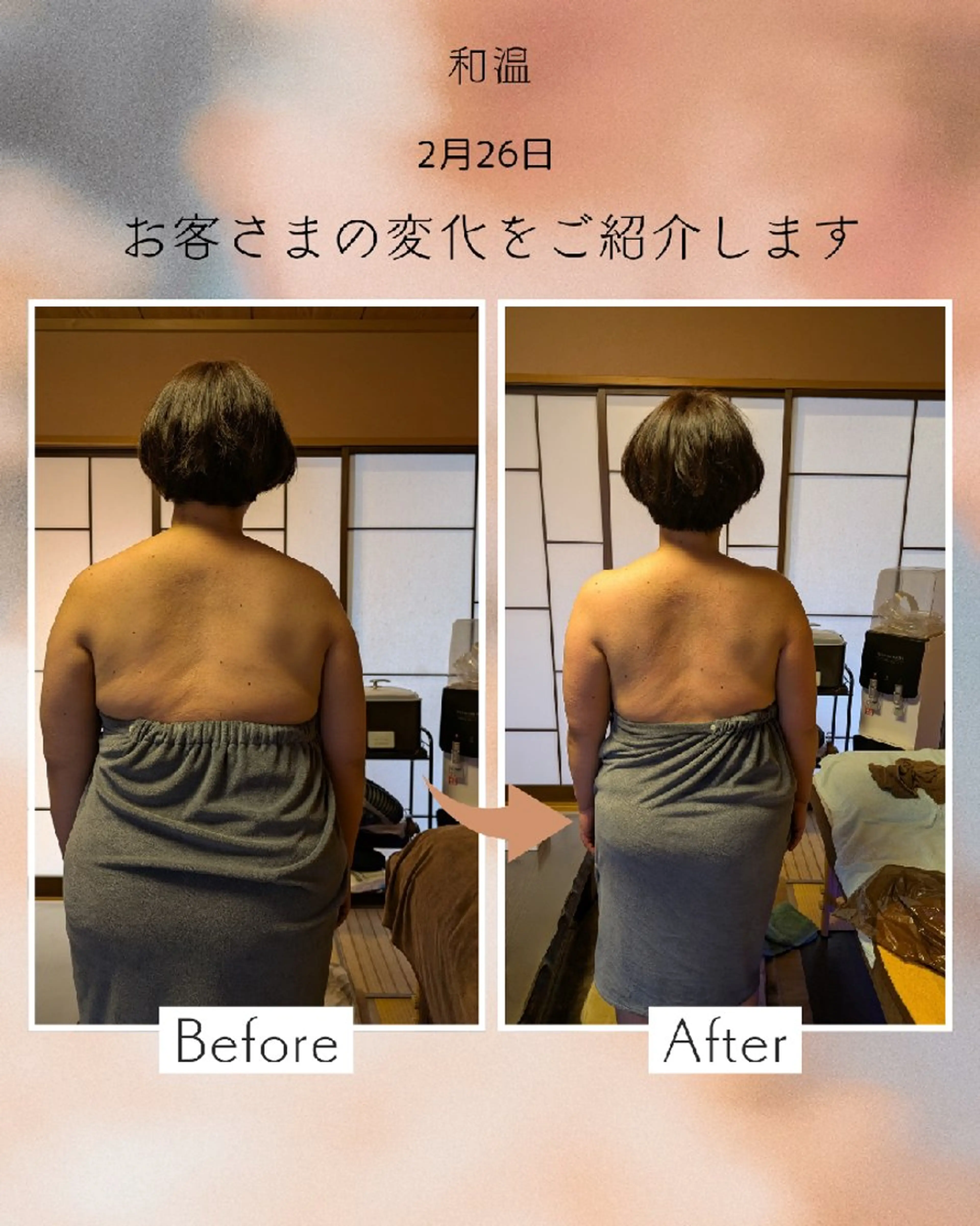 ピピット全身痩身メニュー＋p90＋お腹集中（早い方で1回で写真のように効果が出る方もいます）の写真