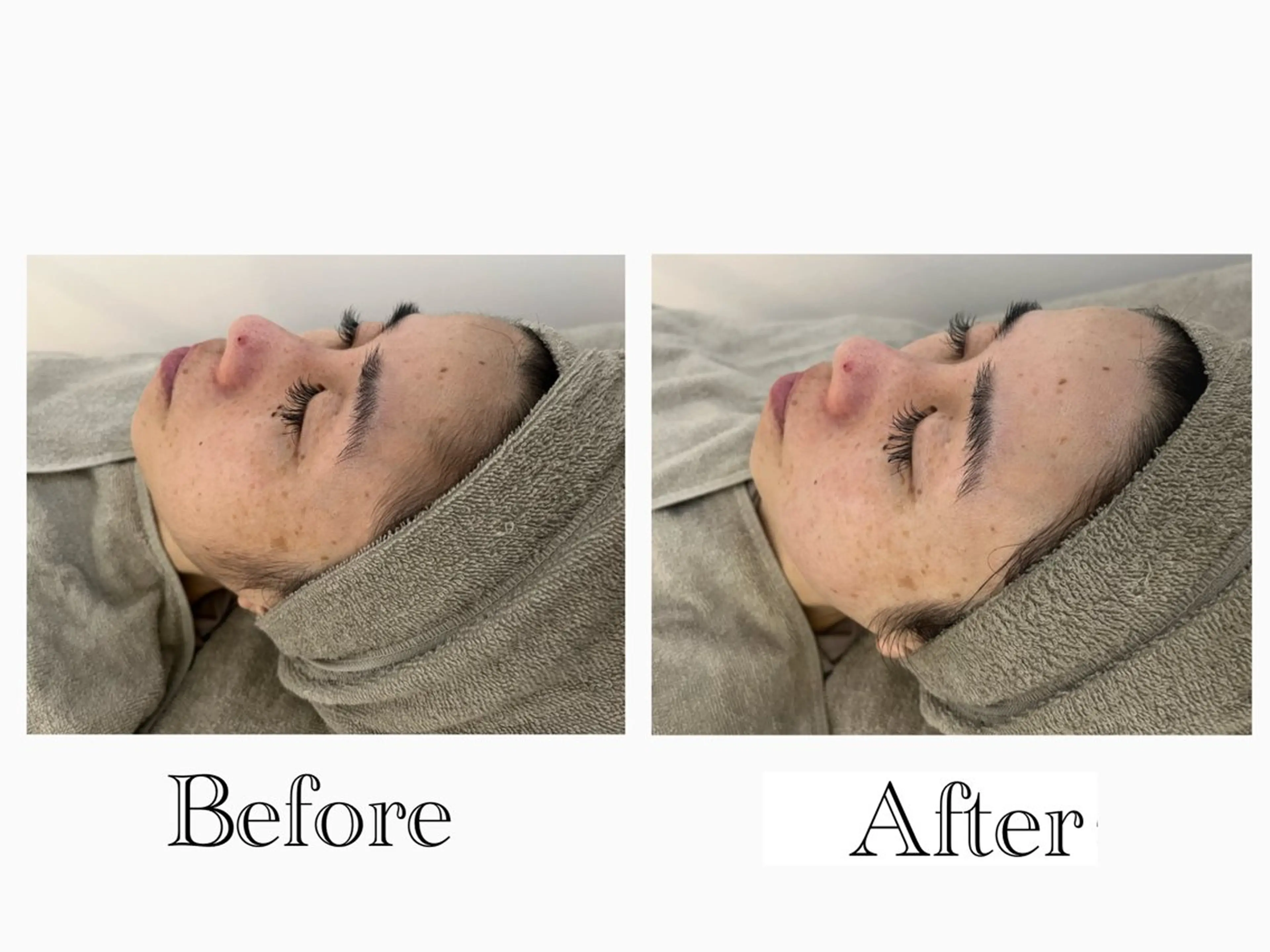 今話題👑(60分)【ヒト幹細胞順化培養液パック付】🌿オールハンドマッサージ💆‍♀️➕ソフトシェービングで産毛ケアの写真