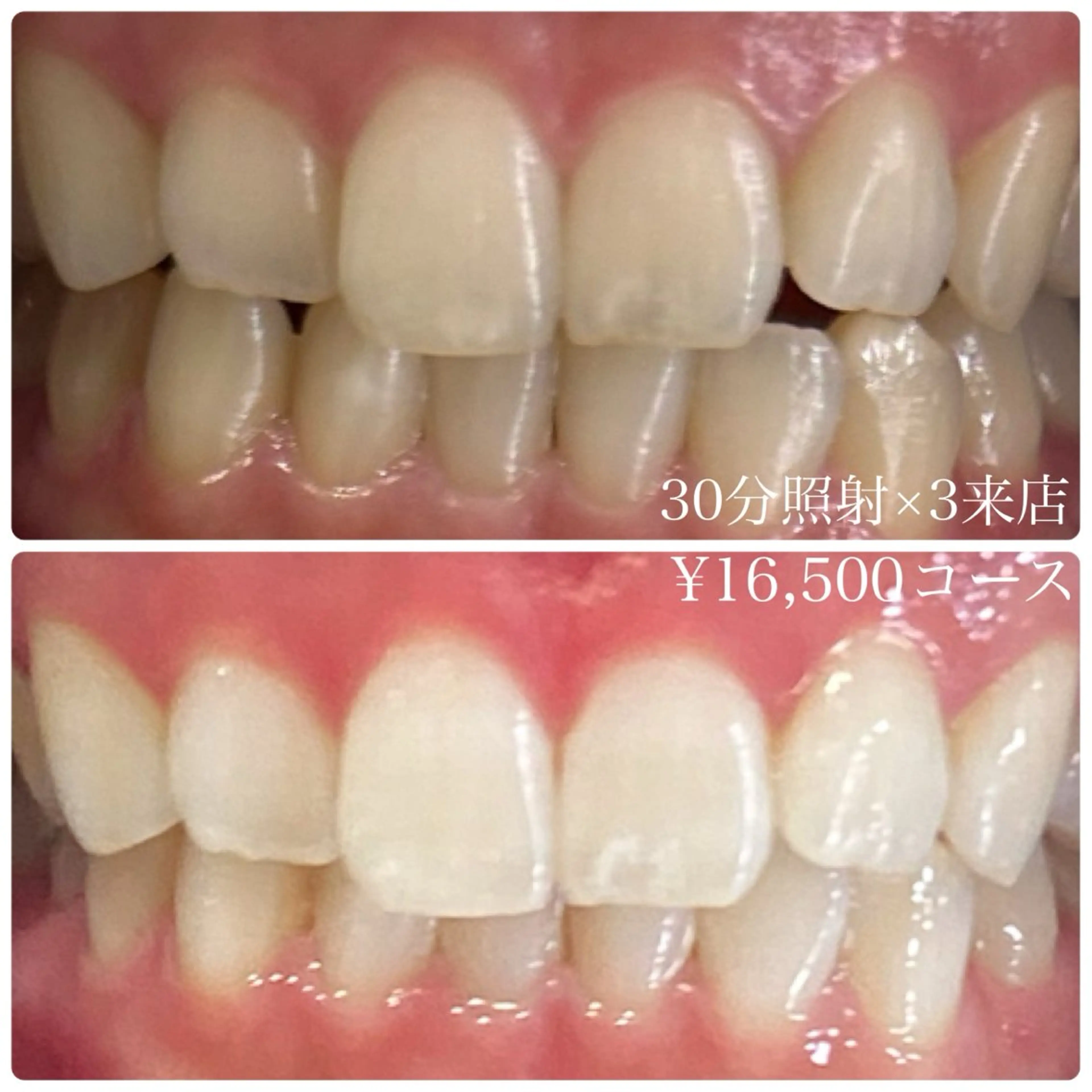 メンズ その他 ホワイトニングルーム 川崎店所属・ホワイトニング ルーム 川崎店のその他イメージ