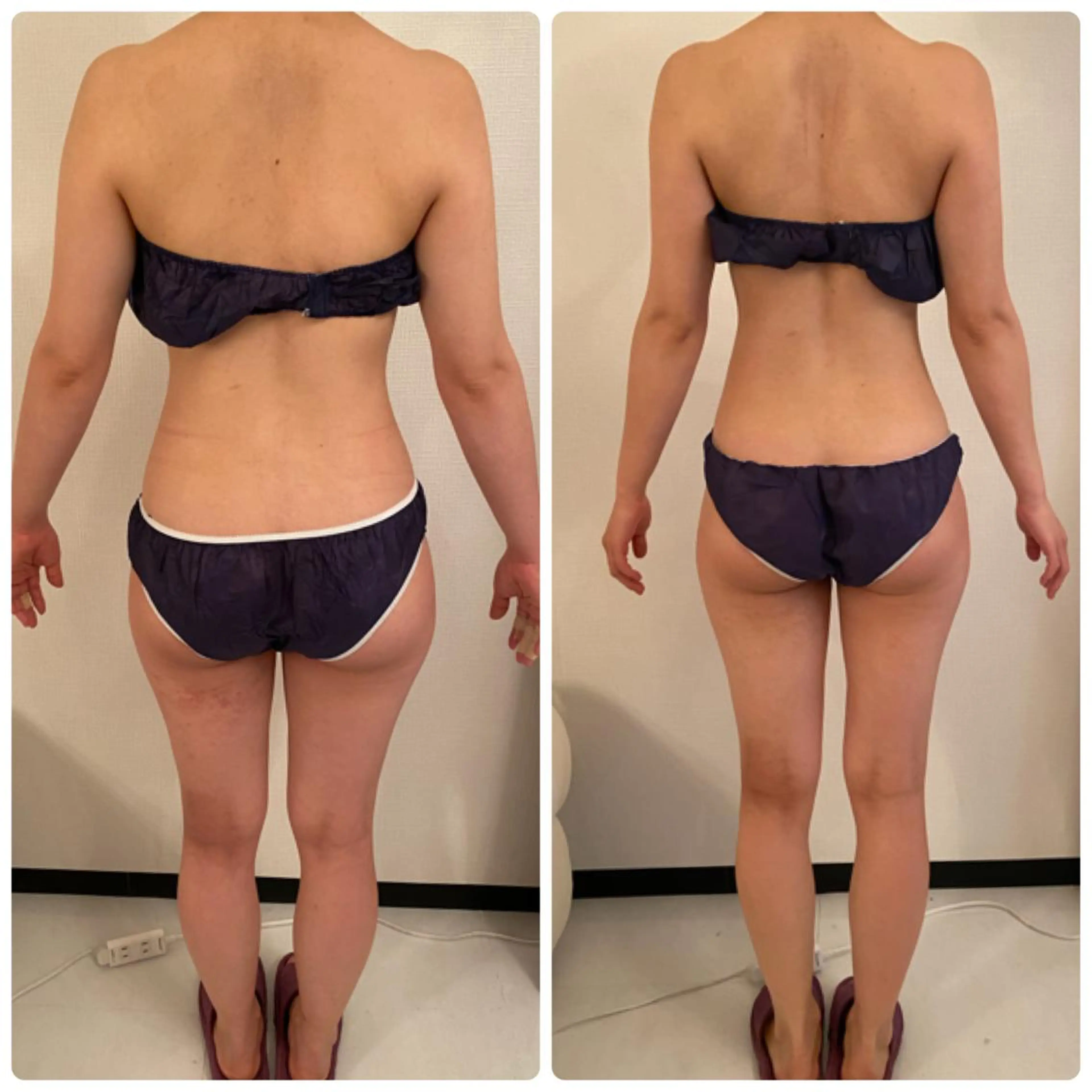 FLEUR大阪・整体 ・ハイフ・痩身・小顔のエステ・リラクイメージ