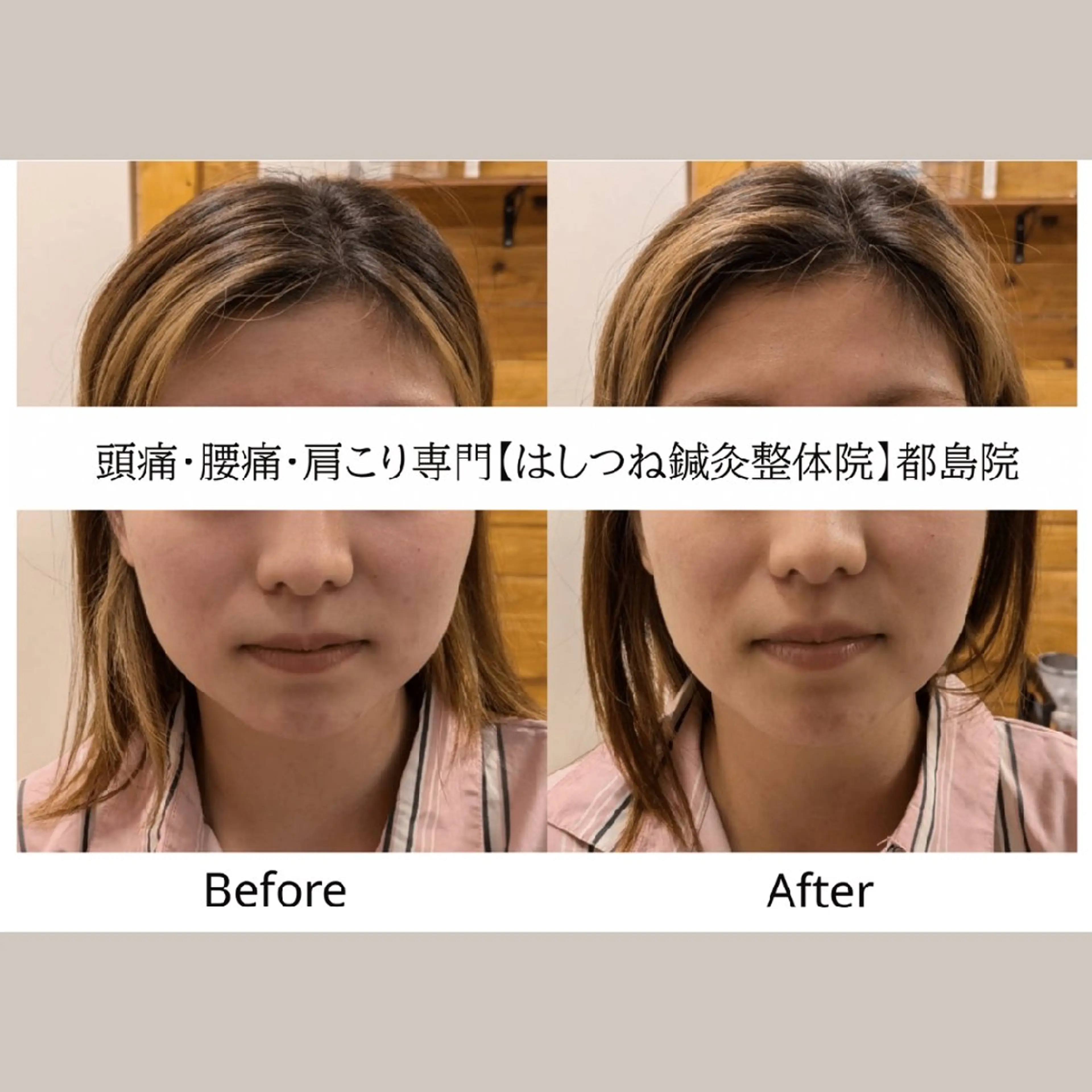 リラク 頭痛・腰痛・美容鍼に 特化してます。　橋岡のエステ・リラクイメージ