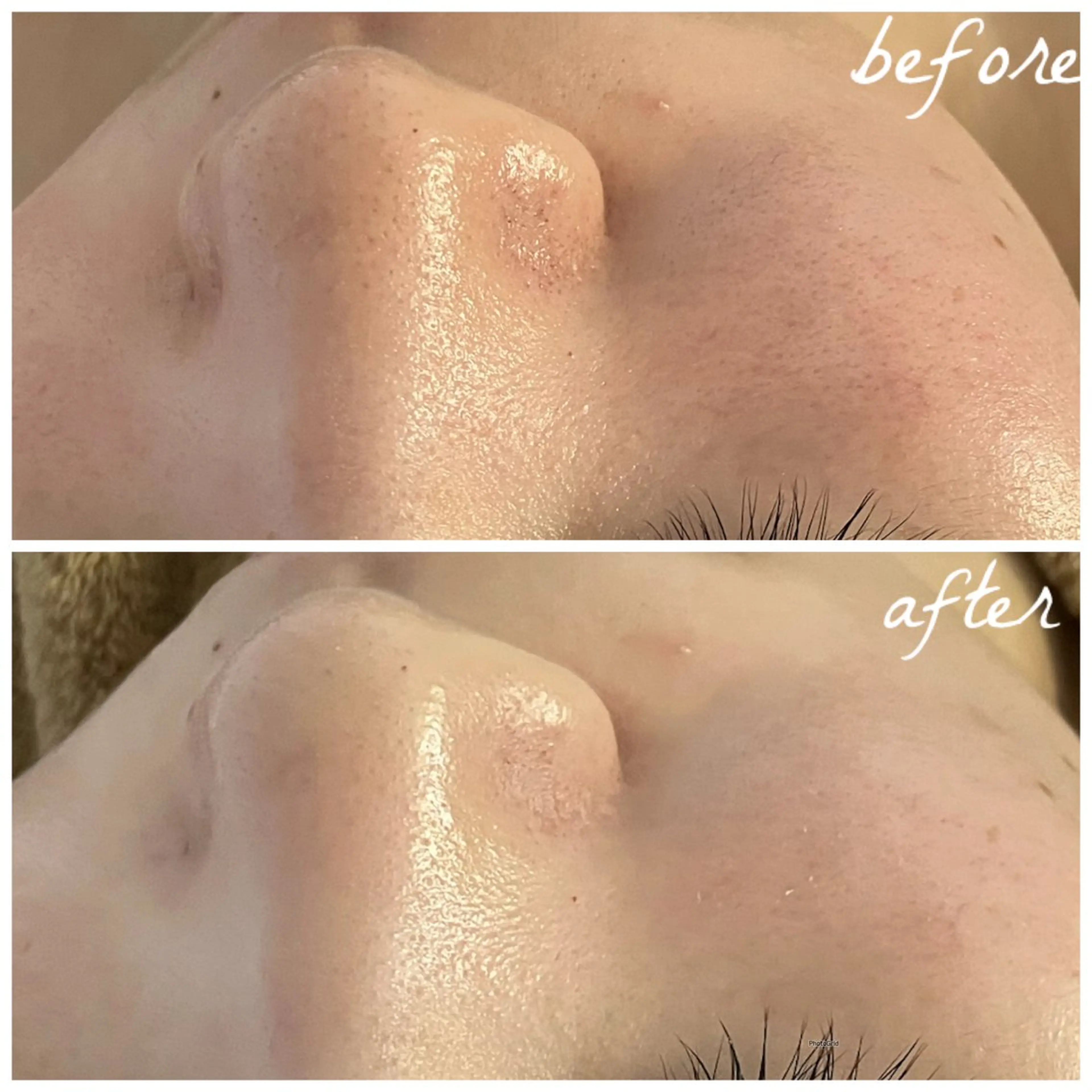 メンズ エステ メナード岐阜茜部 杉浦のエステ・リラクイメージ