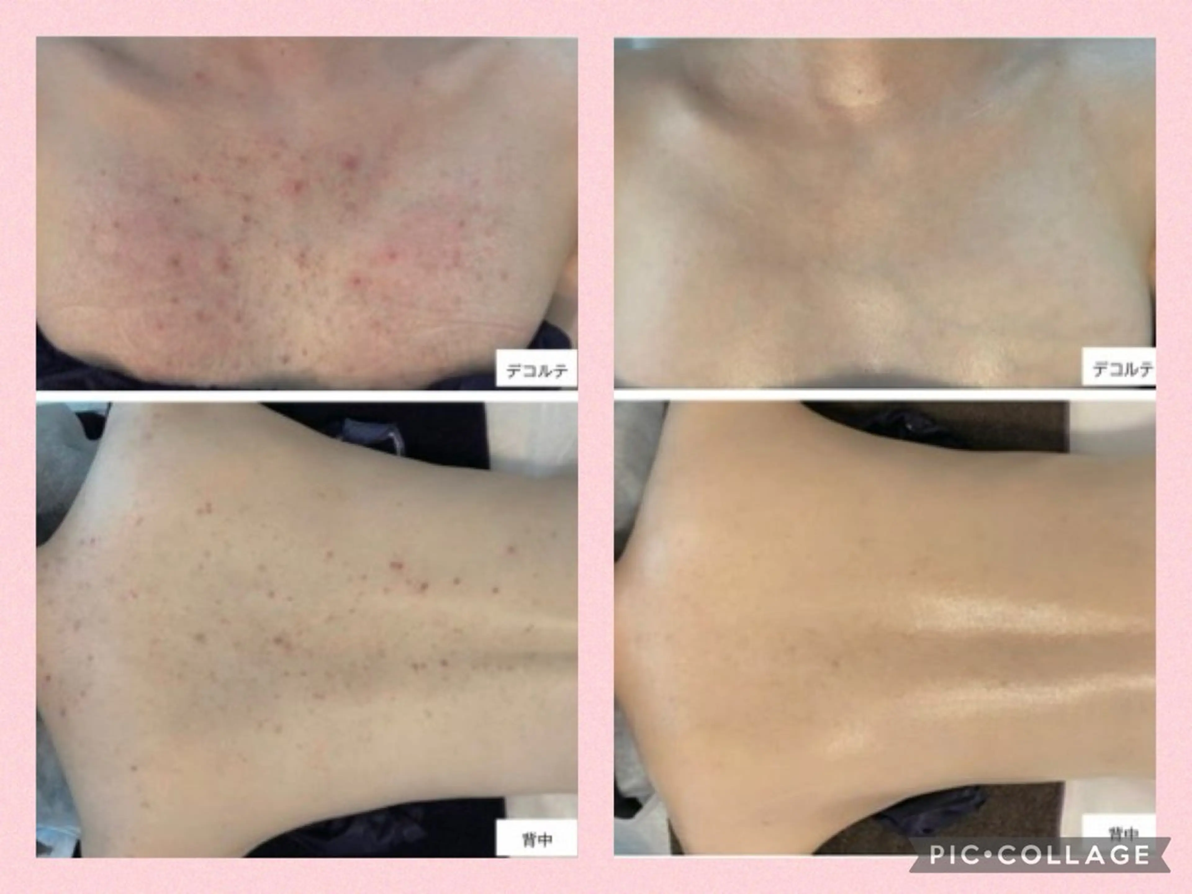 ﾄｰﾀﾙｽｷﾝｹｱ美容Room所属・トータルスキンケア 美容Roomのエステ・リラクイメージ