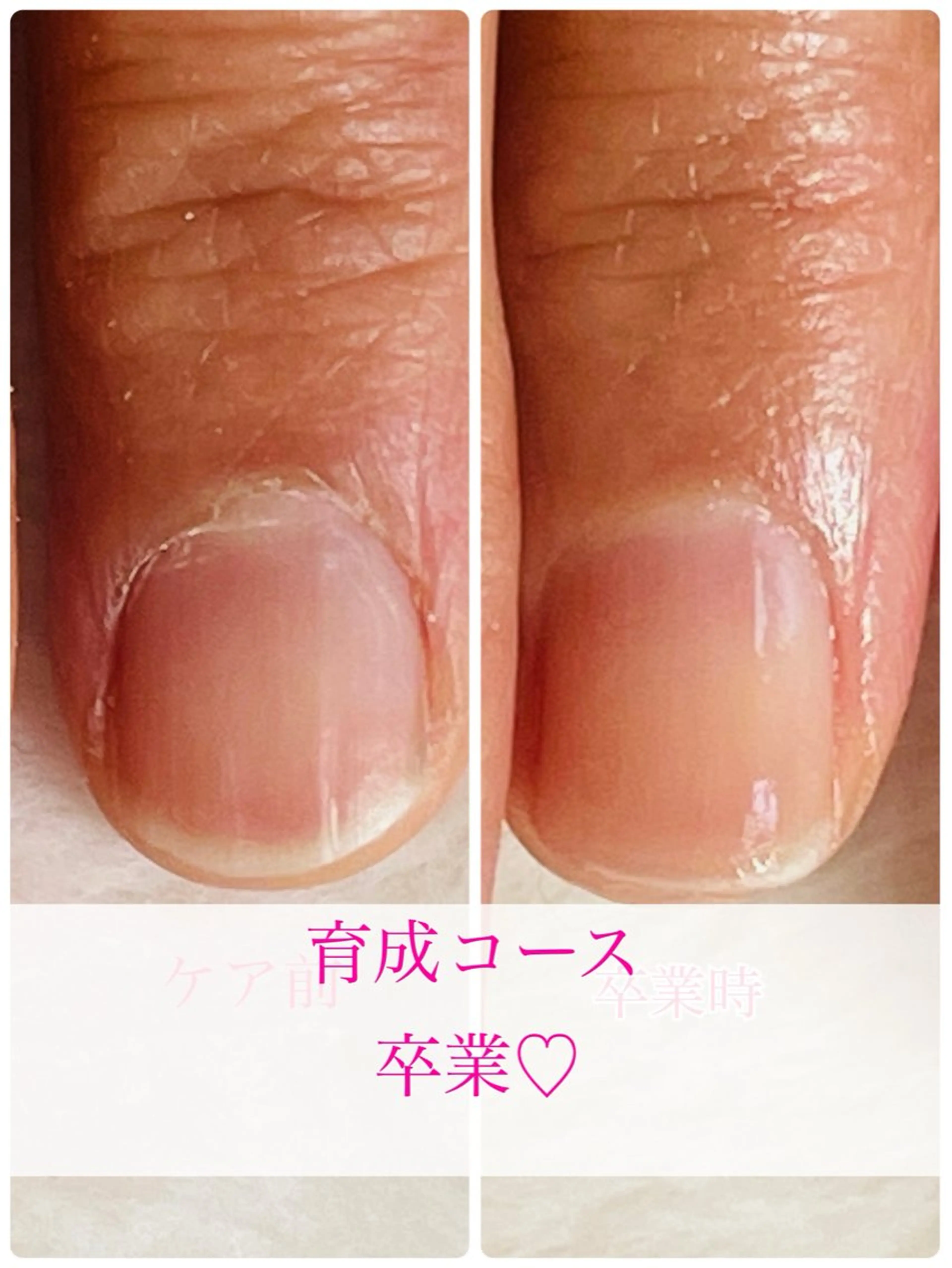 ネイル ジェルネイル Chérinail 爪のお手入れのネイルデザイン