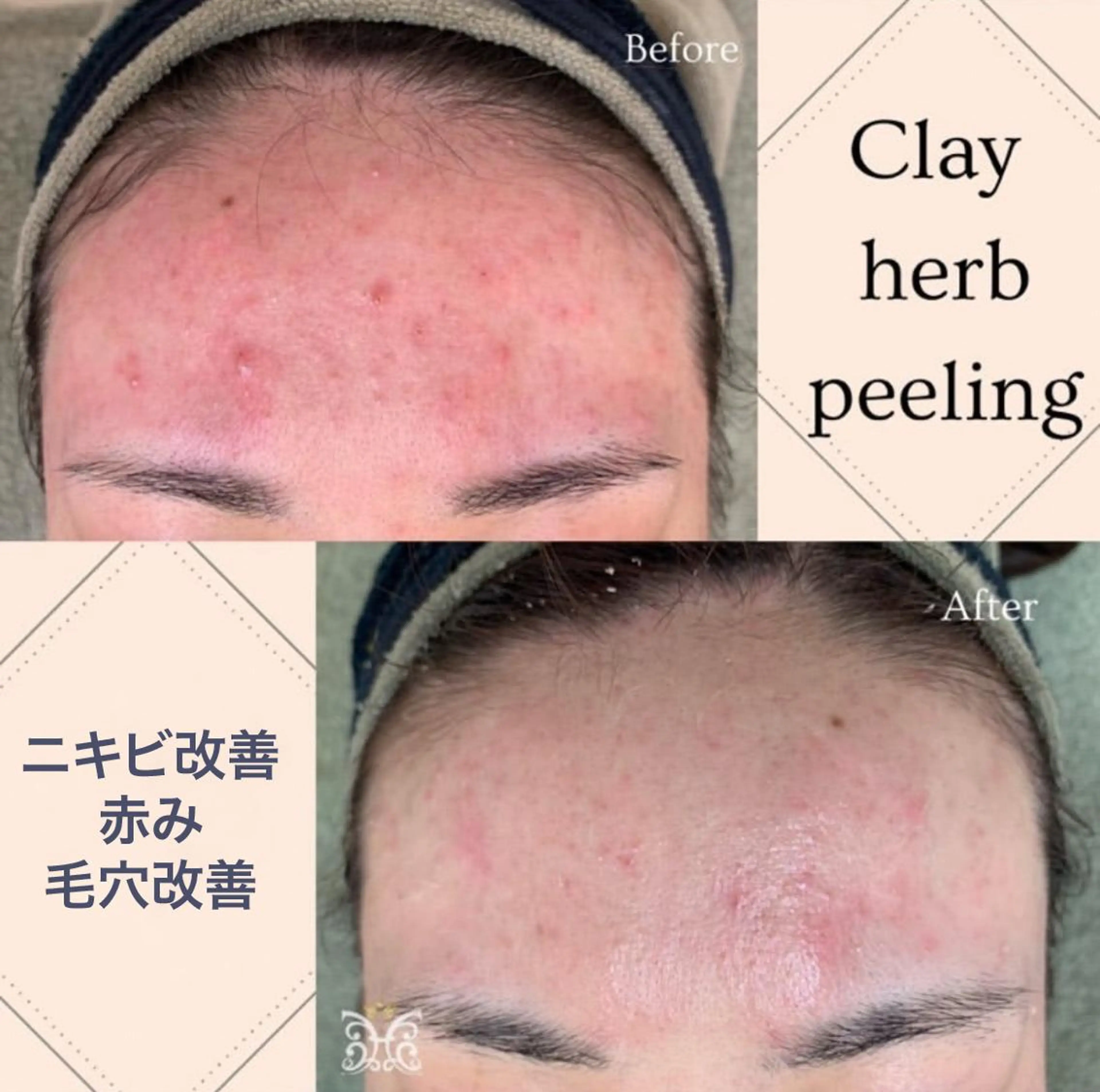 美肌&アロマ🌙 nana 目白/池袋のエステ・リラクイメージ