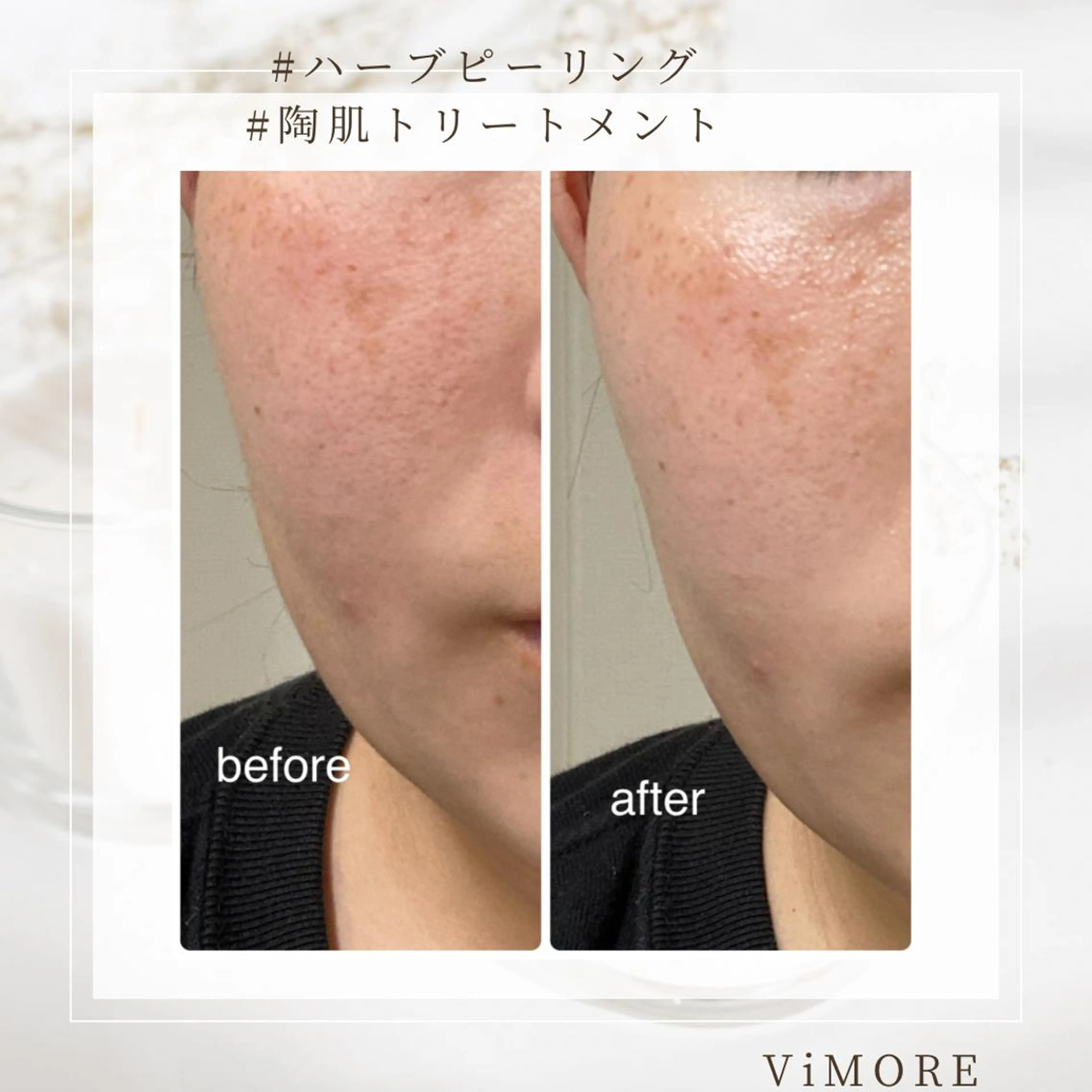 エステ ViMORE あやのネイルデザイン
