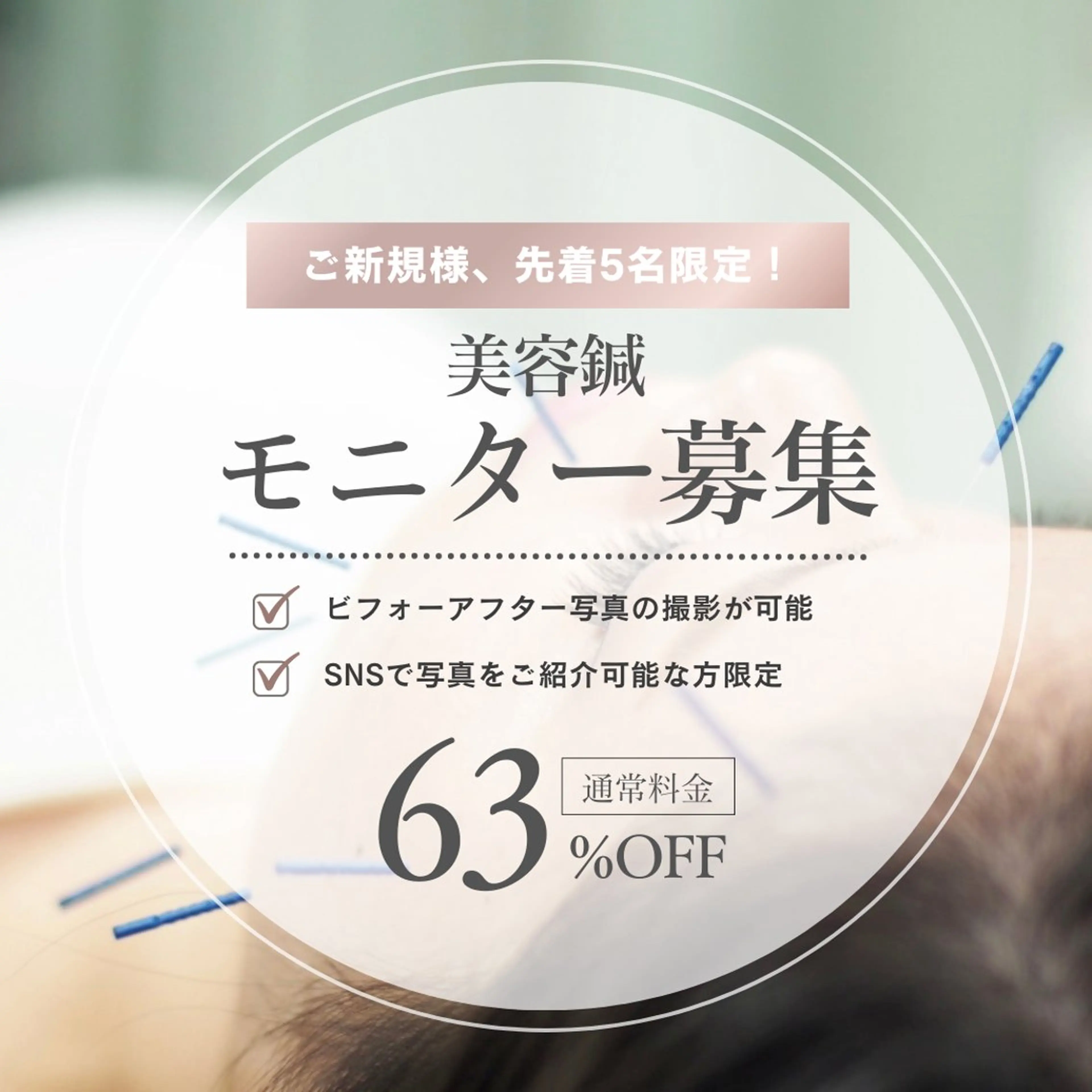 【先着5名限定】モニターメニュー💆‍♀️トライアル美容鍼🪡 ※補足説明要確認（条件あり）の写真